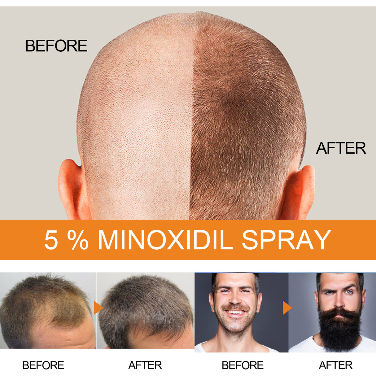 Hair Growth Spray, Men Hair And Beard Thickening Strengthening Anti-loss Care Solution - V.I.P Digital Presence