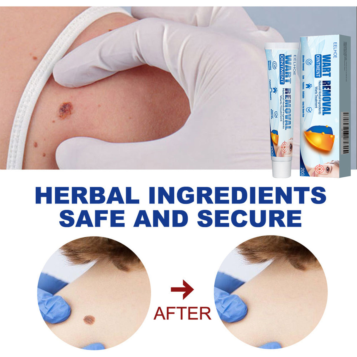 Keyu Cream Clean Skin Repair Care Body Face Remove Face Label Keyu Cream - V.I.P Digital Presence