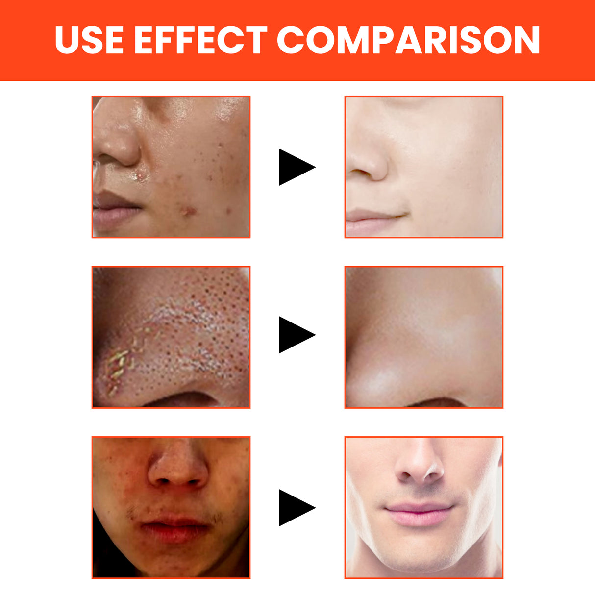 Men's Volcanic Face Wash, Acne Blackhead Face Deep Clean Pores And Oil Control - V.I.P Digital Presence