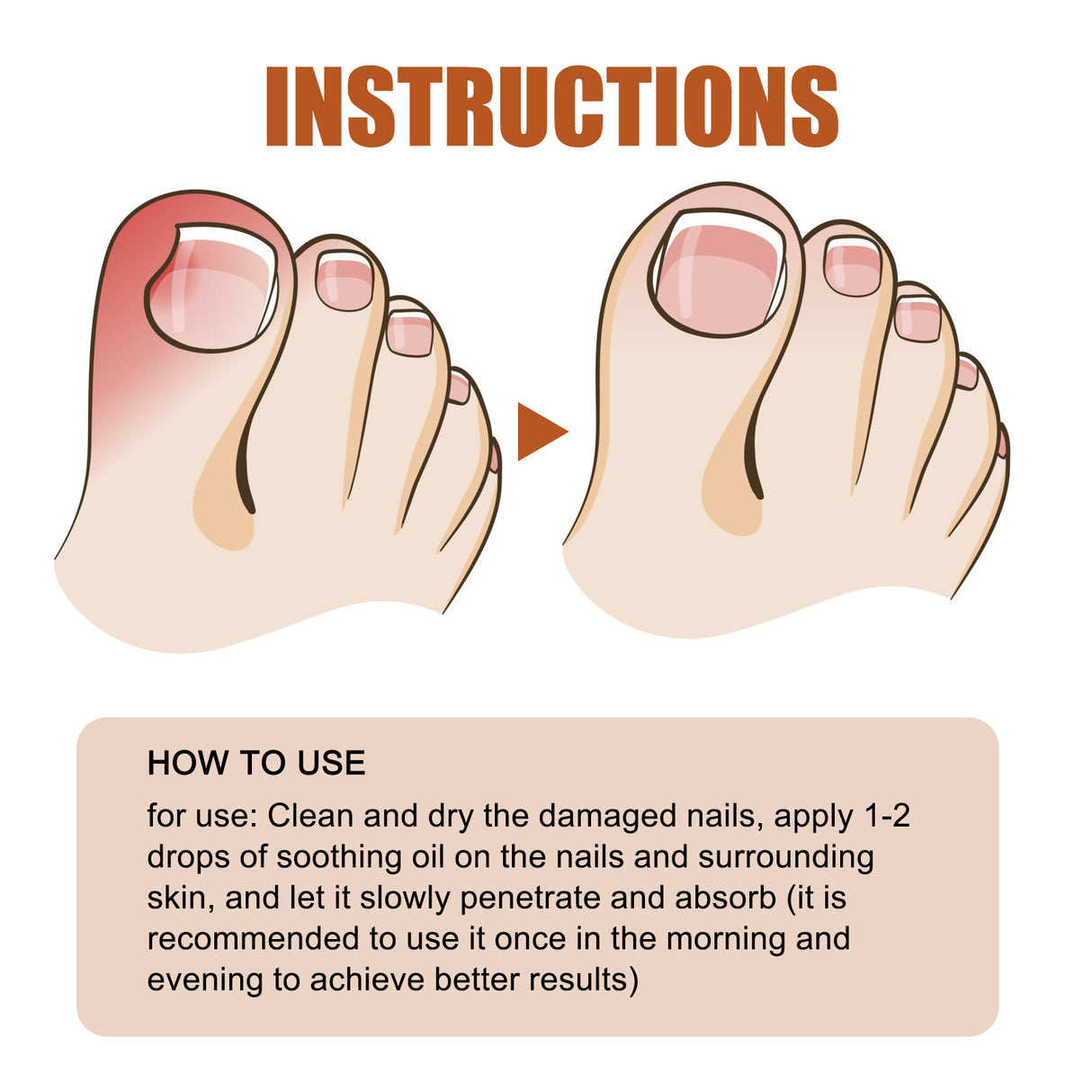 Anti-Nail Groove Relief Oil, Repair Inlaid Nails Gray Nails And Soft Thickening Nail Brightening Nails Care Oil - V.I.P Digital Presence