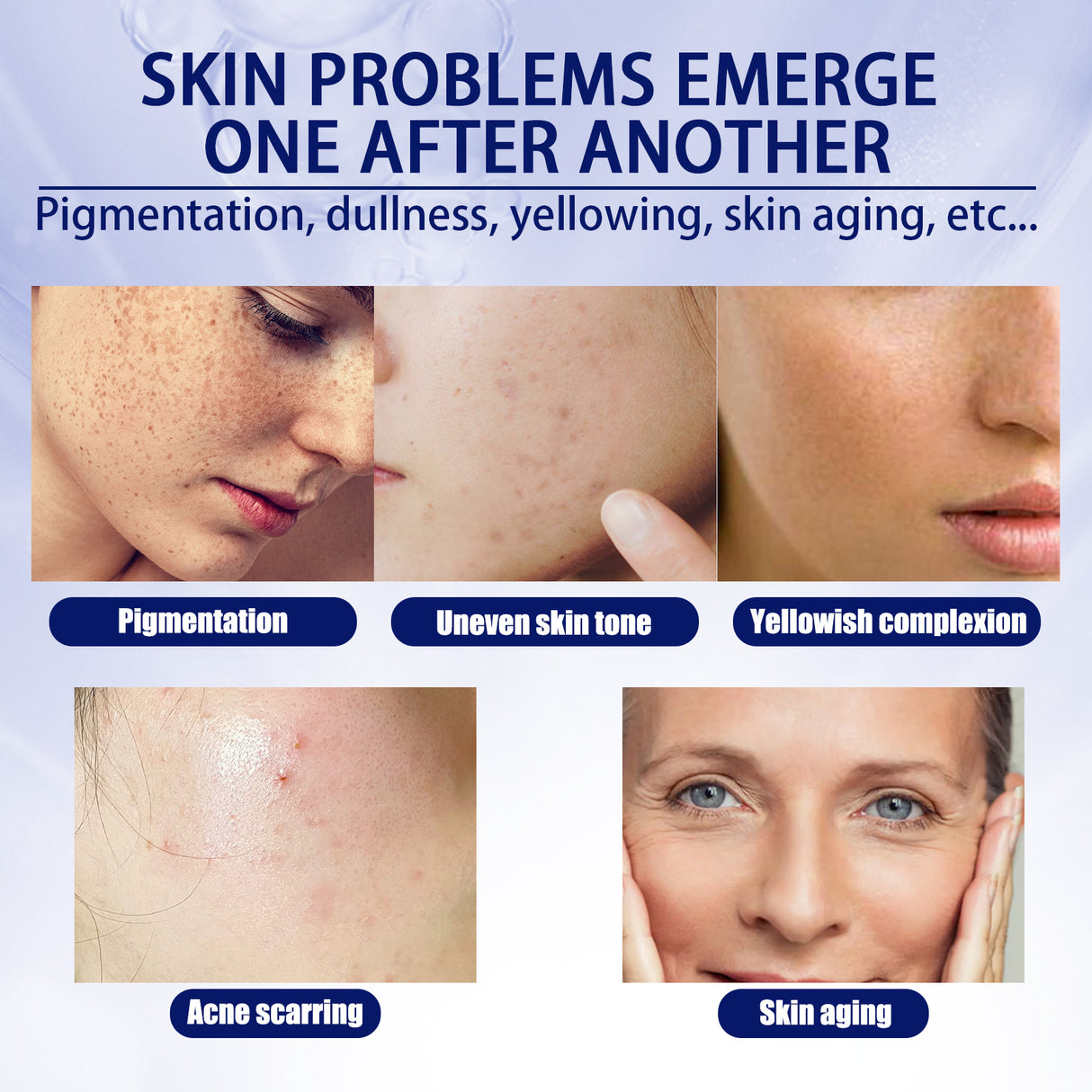 Anti-aging Vitamin C Facial Essence, Reduces Spots Acne Fine Lines, Moisturizes Facial Essence - V.I.P Digital Presence