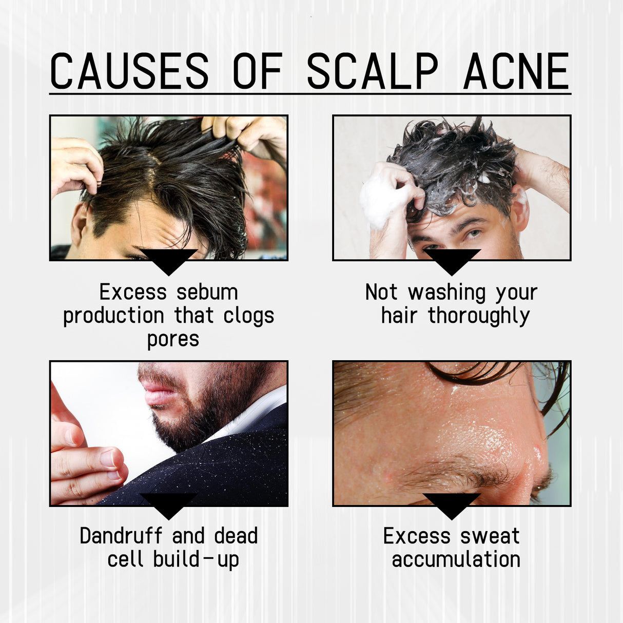 West & Month Anti-Shedding Hair Spray, Improve The Hairline Hair Hair Nutrition Moisture Hair Roots - V.I.P Digital Presence