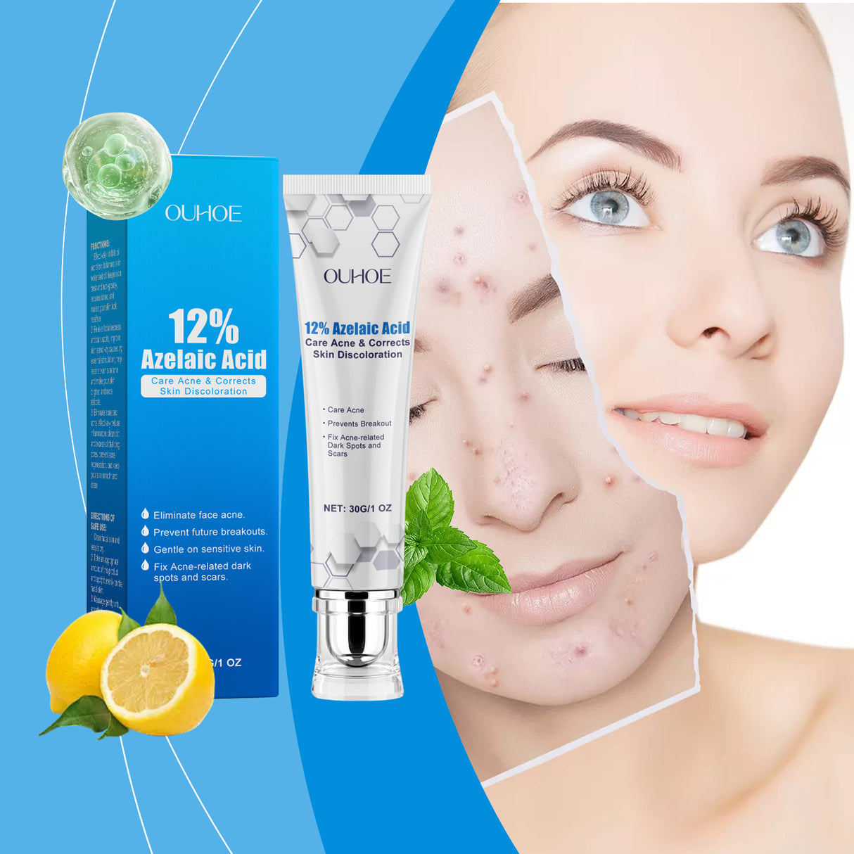 Azelaic Acid Acne Cream Gently Nourishes And Moisturizes Skin And Balances Oil And AcneOuhoe Azelaic Acid Acne Cream Gently Nourishes And Moisturizes Skin And Balances Oil And Acne