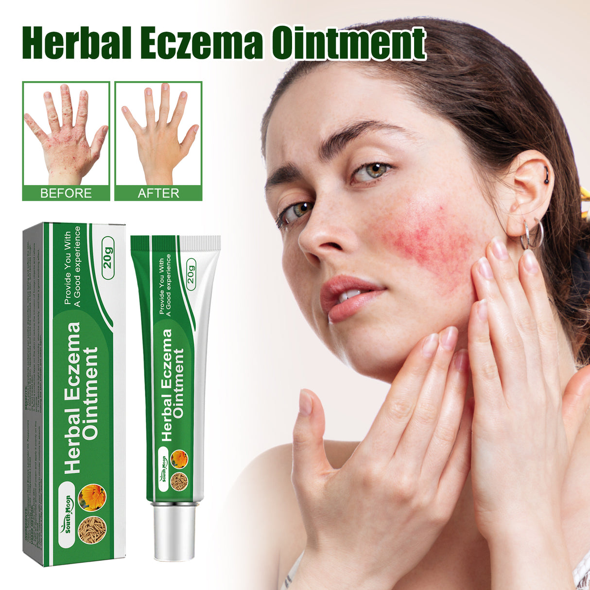 Herbal Eczema Ointment, Relieve Hand And Foot Moss Skin Redness Itchy Skin Repair Ointment - V.I.P Digital Presence