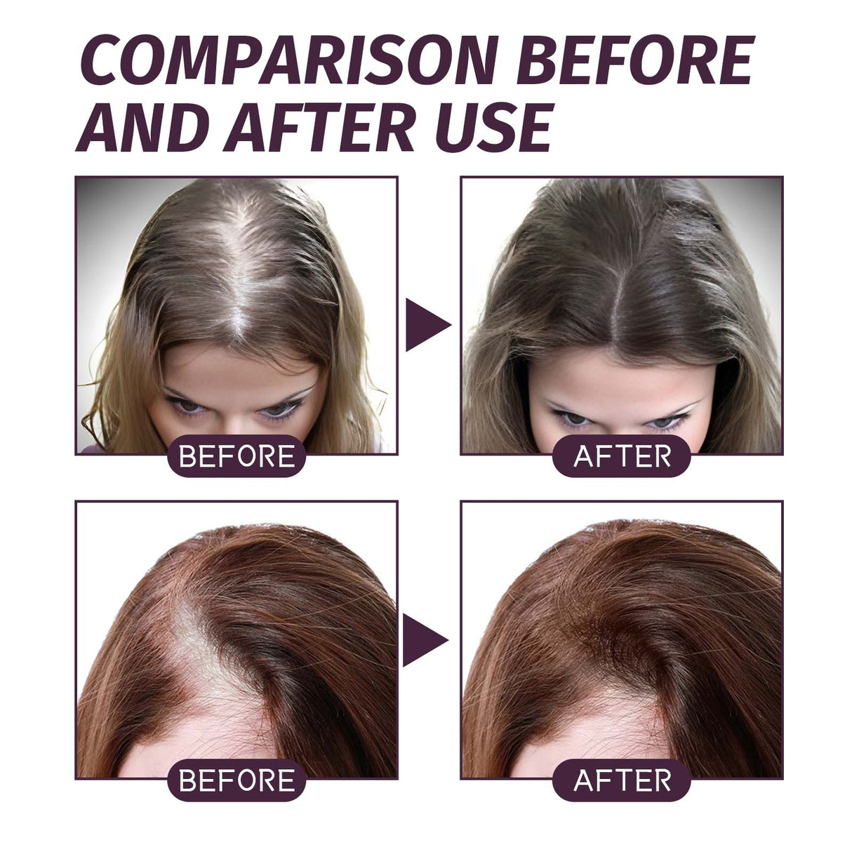 Volumizing And Dense Hair Spray, Repair Dry Hair, Strengthen Hair Nourishing And Volumizing Hair Treatment Spray - V.I.P Digital Presence