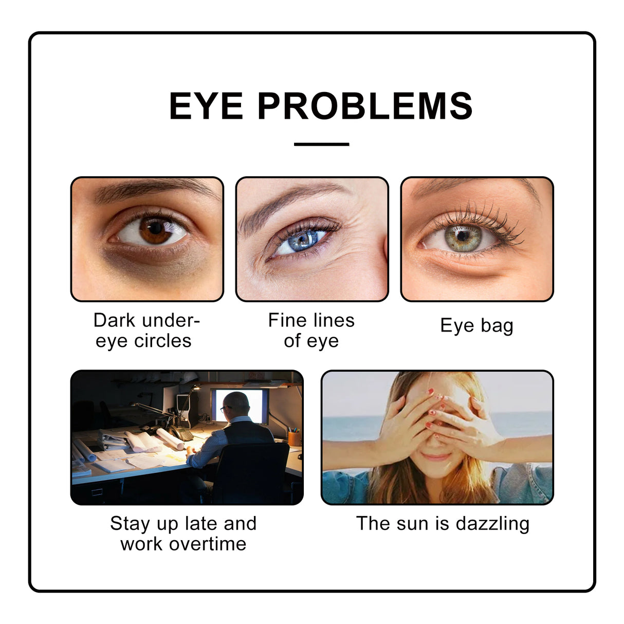 Eye Roller Eye Cream Ball Massage To Reduce Fine Lines, Bags, Puffiness And Dark Circles Around The Eyes