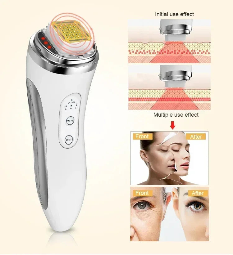 Electric Facial Lifting Machine Dot Matrix Skin Tightening Rejuvenation Wrinkle Removal Face Massager Home Use Beauty Devices - V.I.P Digital Presence