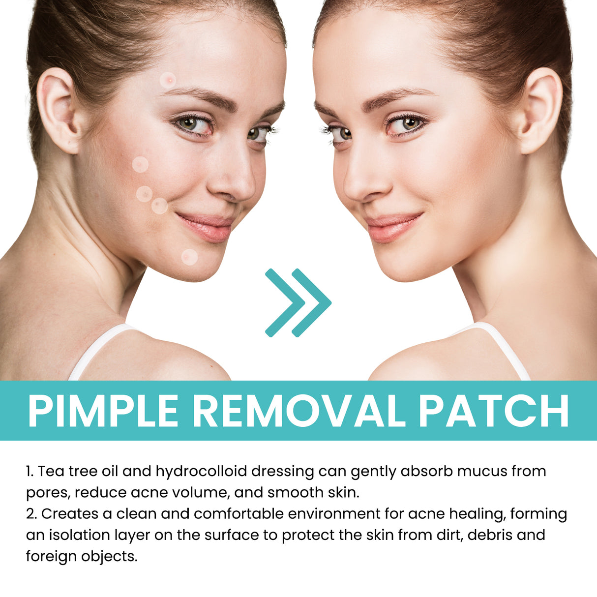 Acne Patch Repair Acne Patch Pore-Cleansing Invisible Breathable Concealer Waterproof Acne Patch
