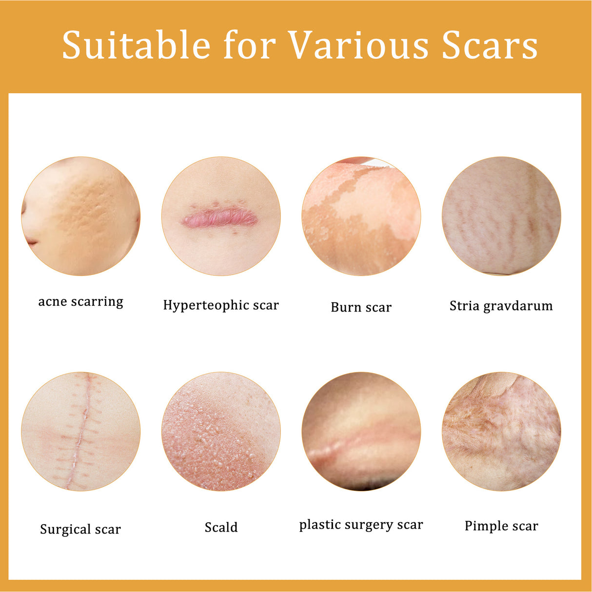 Desalting Skin Scar Cream, Skin Burn Scalding Surgical Scar Wound Repair Cream - V.I.P Digital Presence