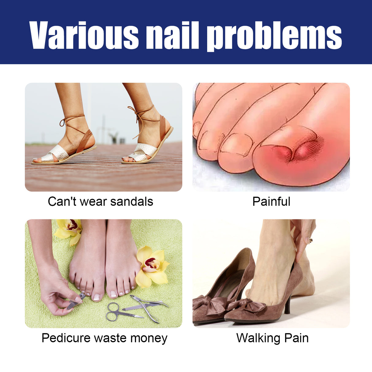 Nail Repair Solution Gentle Clean, Moisturize, Moisturize And Nourish Nails And Nails