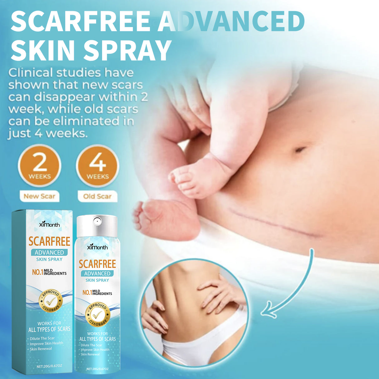 Scarfree Advanced Skin Spray, Body Skin Care Reduces Post-Natal Scars And Smooths Skin - V.I.P Digital Presence