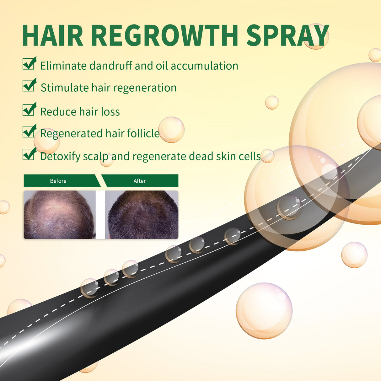 Hair Growth Spray, Thickening Preventing Loss And Repairing Hair Follicle Damage Dry And Frizzy Hair Spray - V.I.P Digital Presence