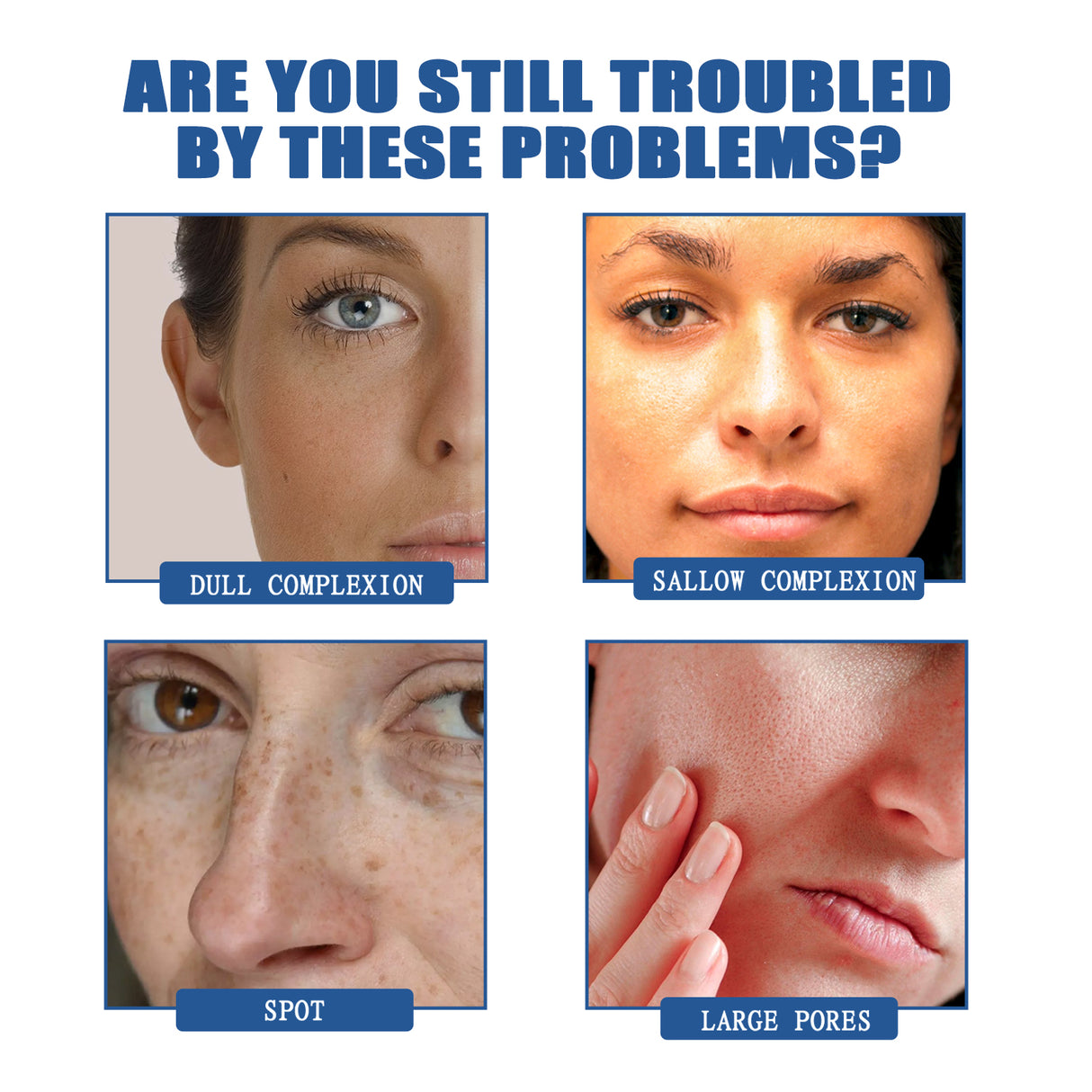 Spot Reduction Serum Skin Care Serum For Reducing Pores, Hydrating, Anti-Wrinkle And Brightening Skin