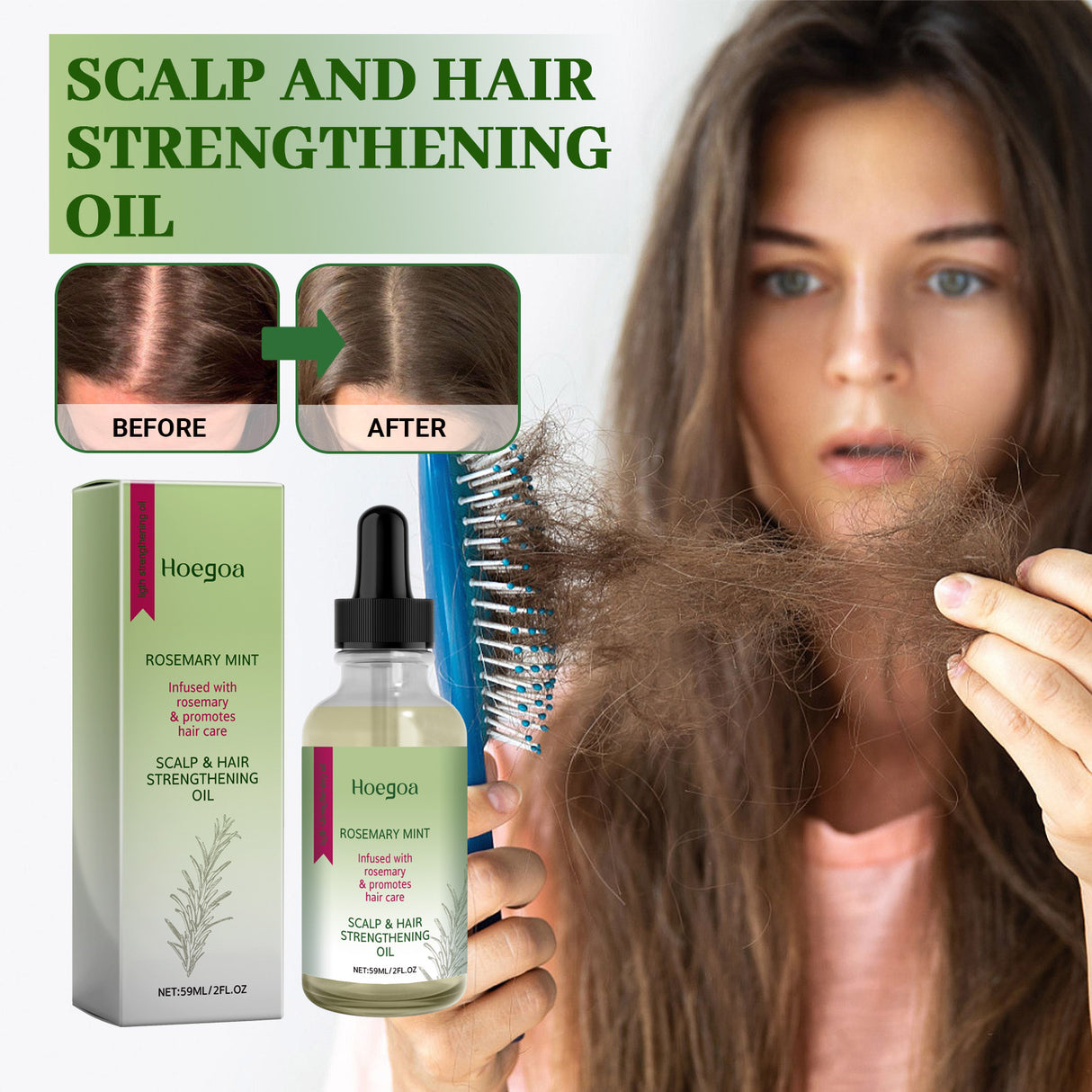 Scalp & Hair Strengthening Oil, Hair Thick Hair Solid Hair Soft Hair Dry Damaged Care - V.I.P Digital Presence