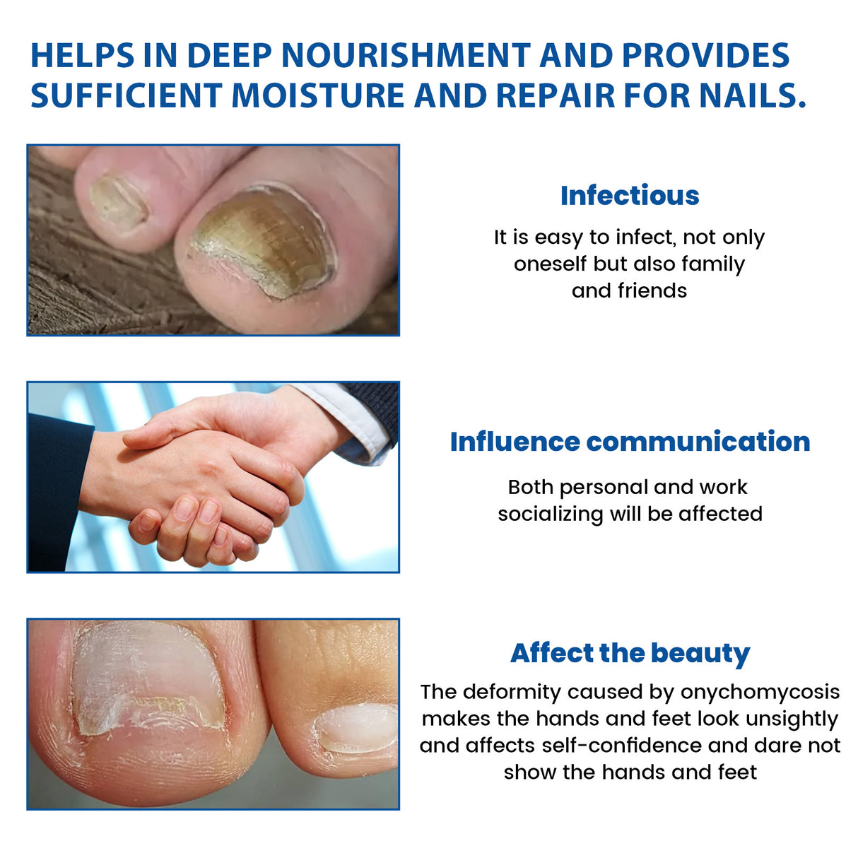 Nighttime Renewal Fungal Nail Patches, Repair And Thickening Gray Nail Insert Soft Nail Care Patch - V.I.P Digital Presence