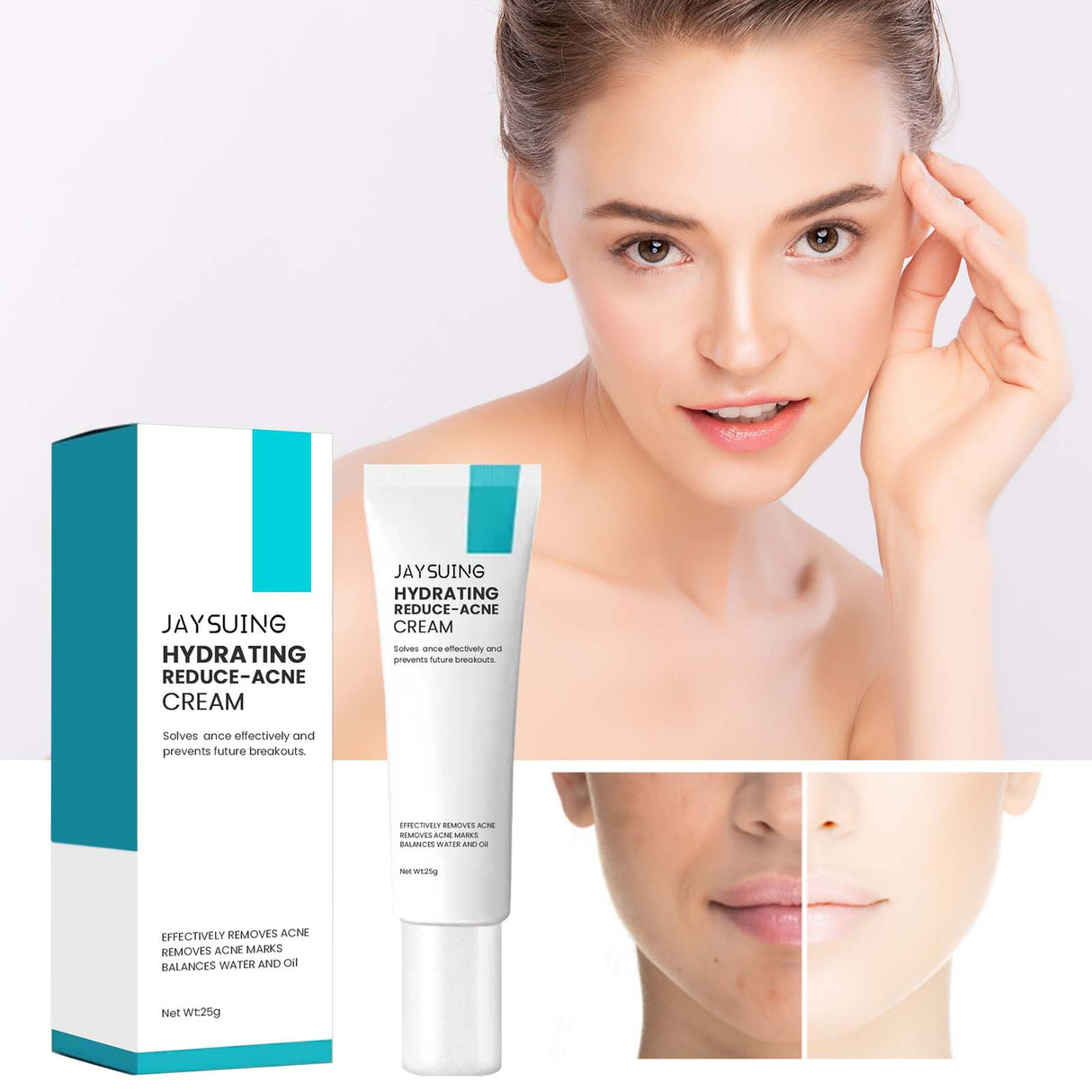 Brightening Anti-Acne Cream, Lighten Acne Pimples, Shrink Pores, Moisturize Skin Brightening Cream