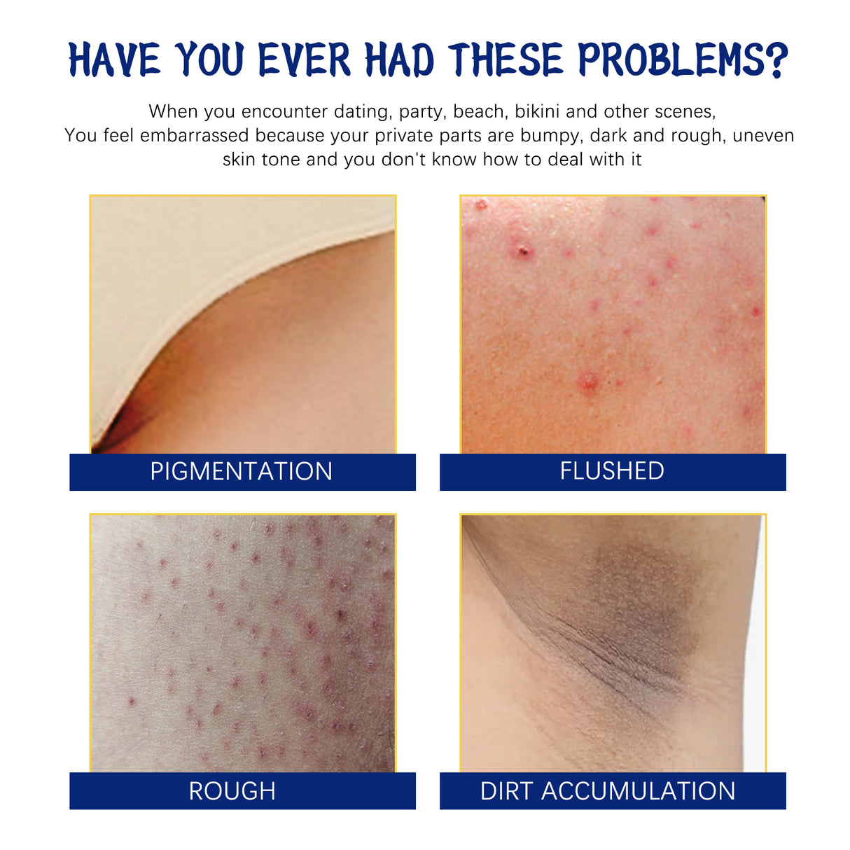 Body Whitening Cream, Lightening Dull Skin Even Skin Tone Moisturizing Skin Beauty Cream - V.I.P Digital Presence