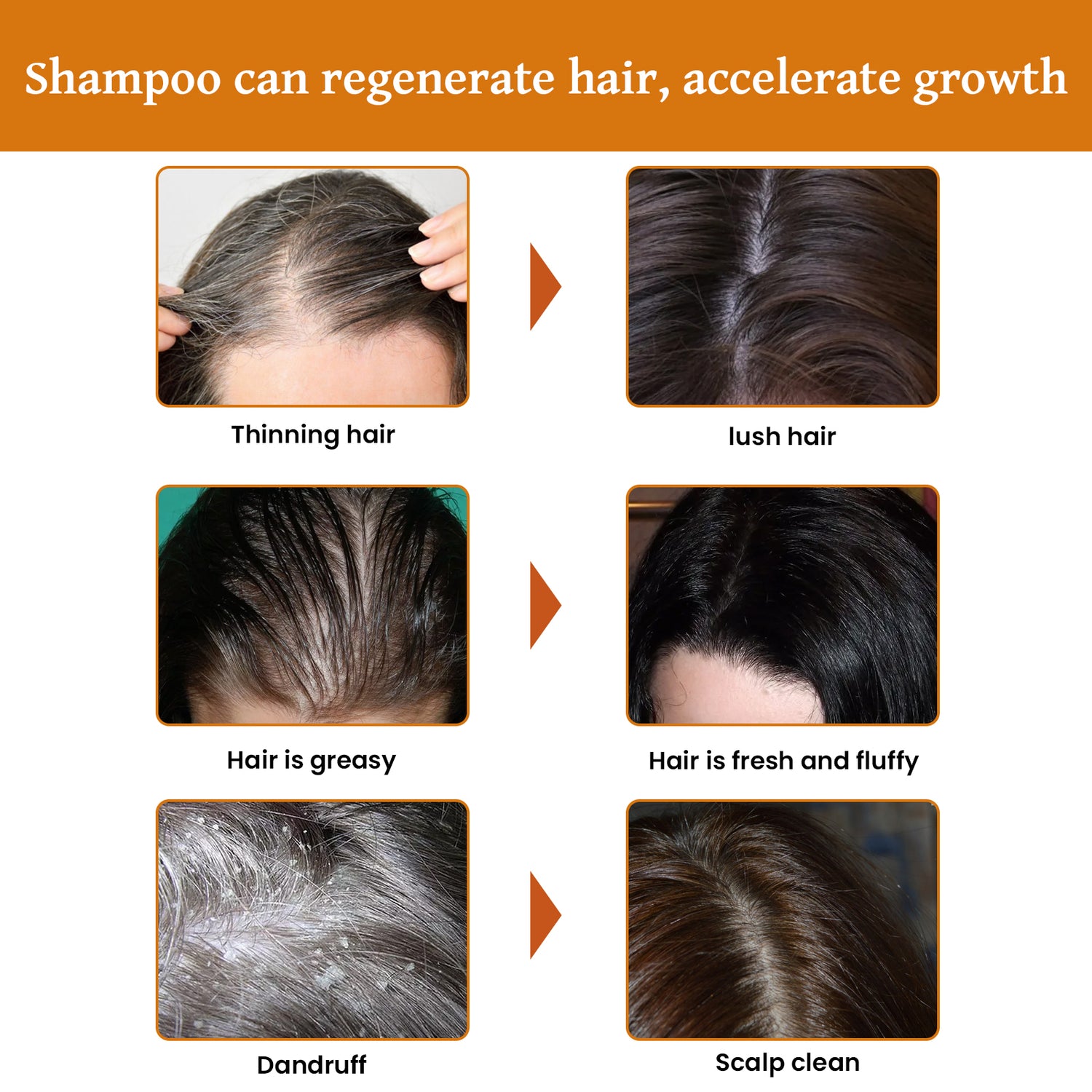 Rice Dense Hair Shampoo Deep Clean Thick Hair Moisturizing Hair Root Solid Hair Care Shampoo - V.I.P Digital Presence