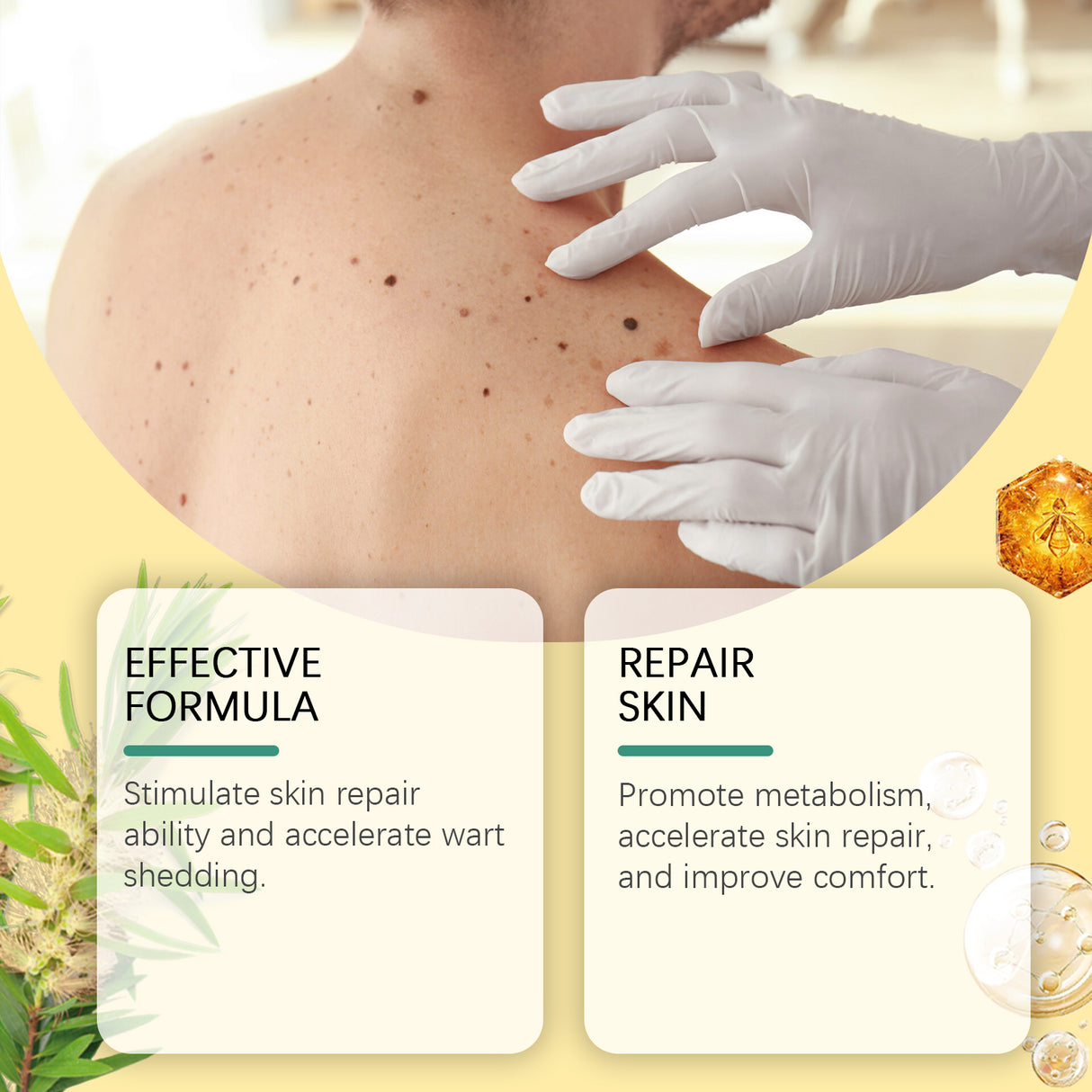 Bee Venom Wart & Mole Removal Spray, Gentle Cleansing Skin Moisturizing Moisturizing Smooth Skin Care - V.I.P Digital Presence