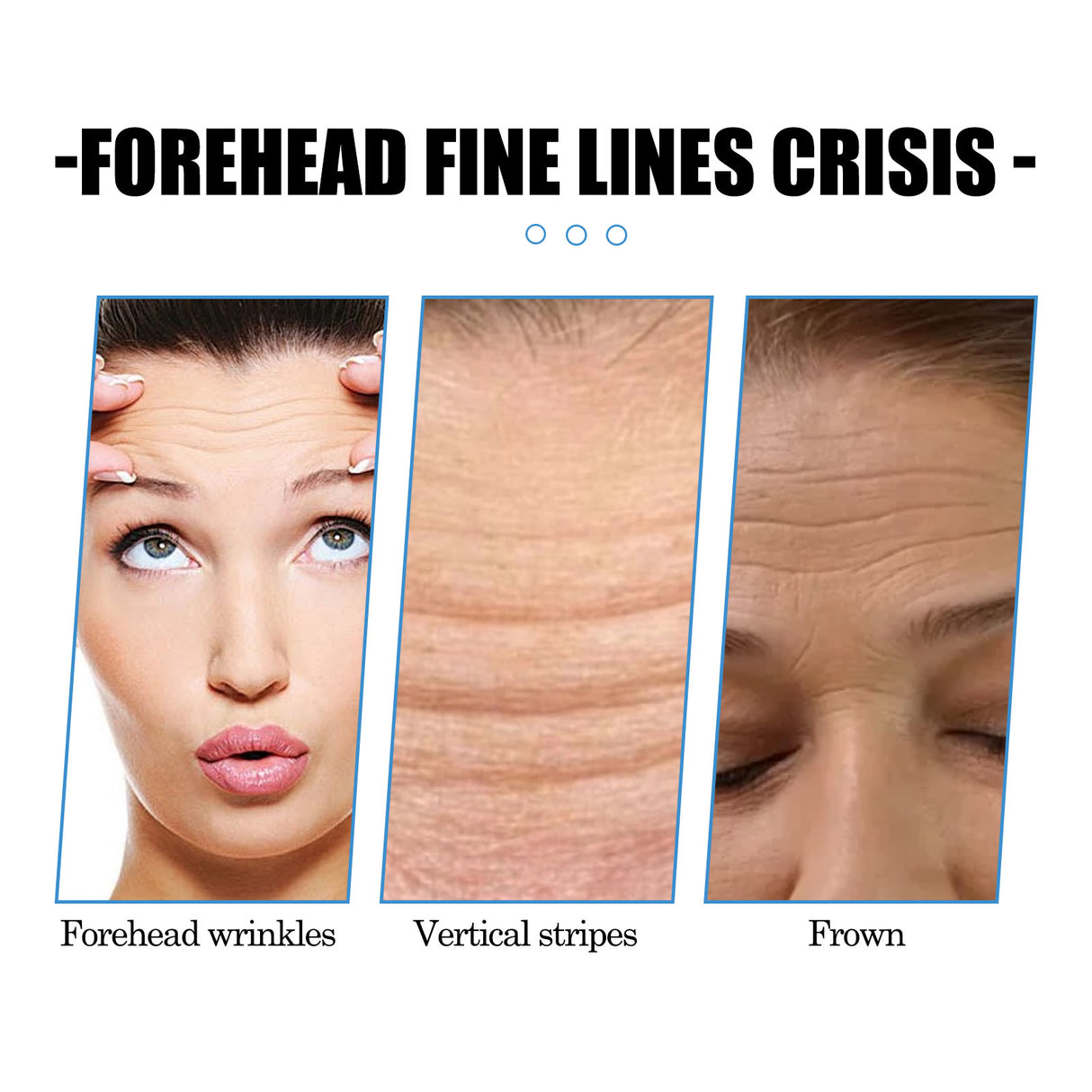 Forehead Care Patch Reduces Raised Head Lines, Firming Skin, Hydrating And Smoothing Skin Patch - V.I.P Digital Presence