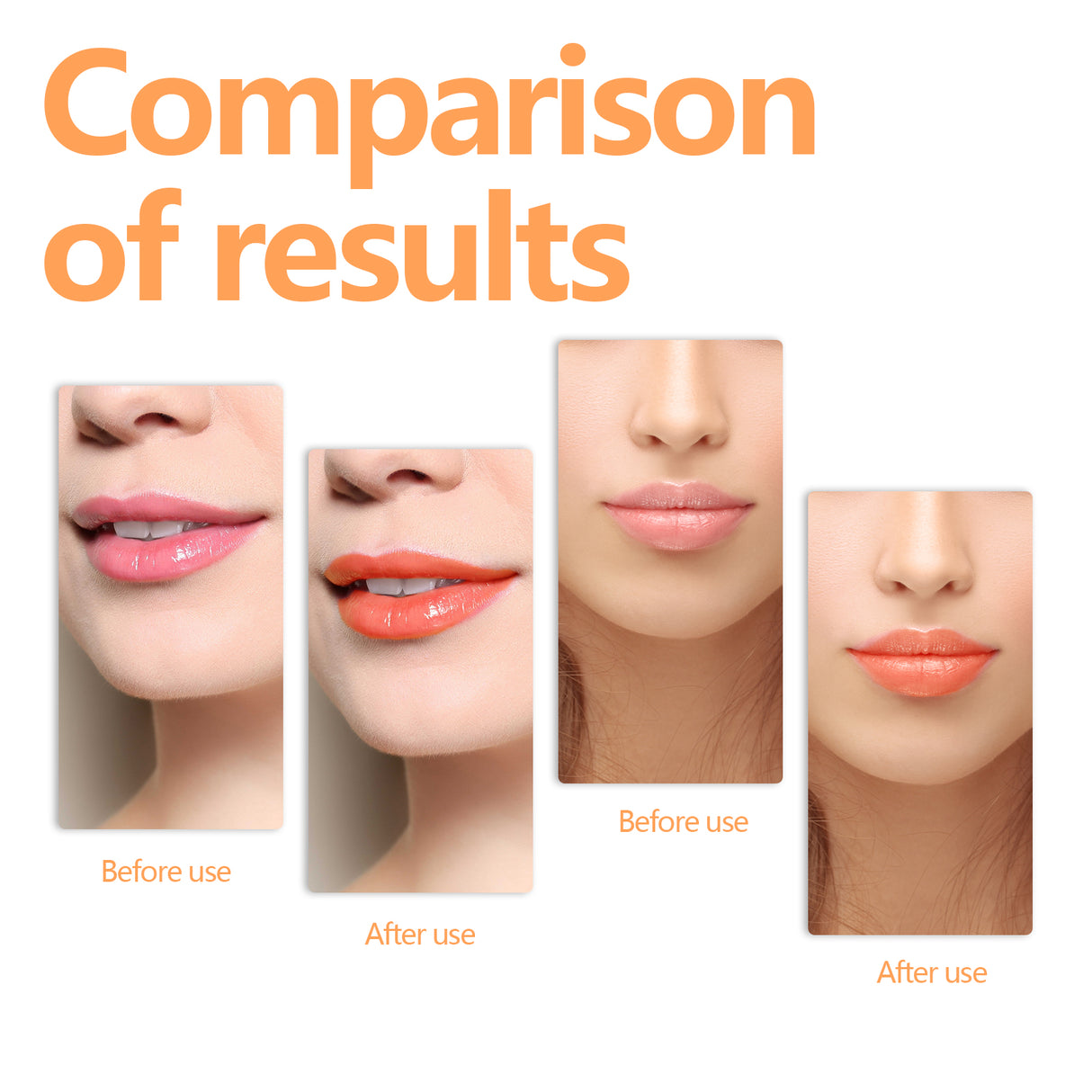 Changing Lip Oil, Mildly Removes The Lips Cutin Plentiful Full Fine Light Zerun Lip Oil - V.I.P Digital Presence
