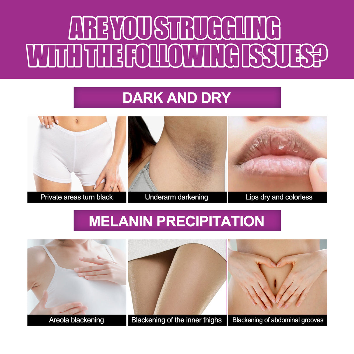 Skin Firming Cream, Brightening Skin Melanin Removal Brightening Skin Moisturizing Cream - V.I.P Digital Presence