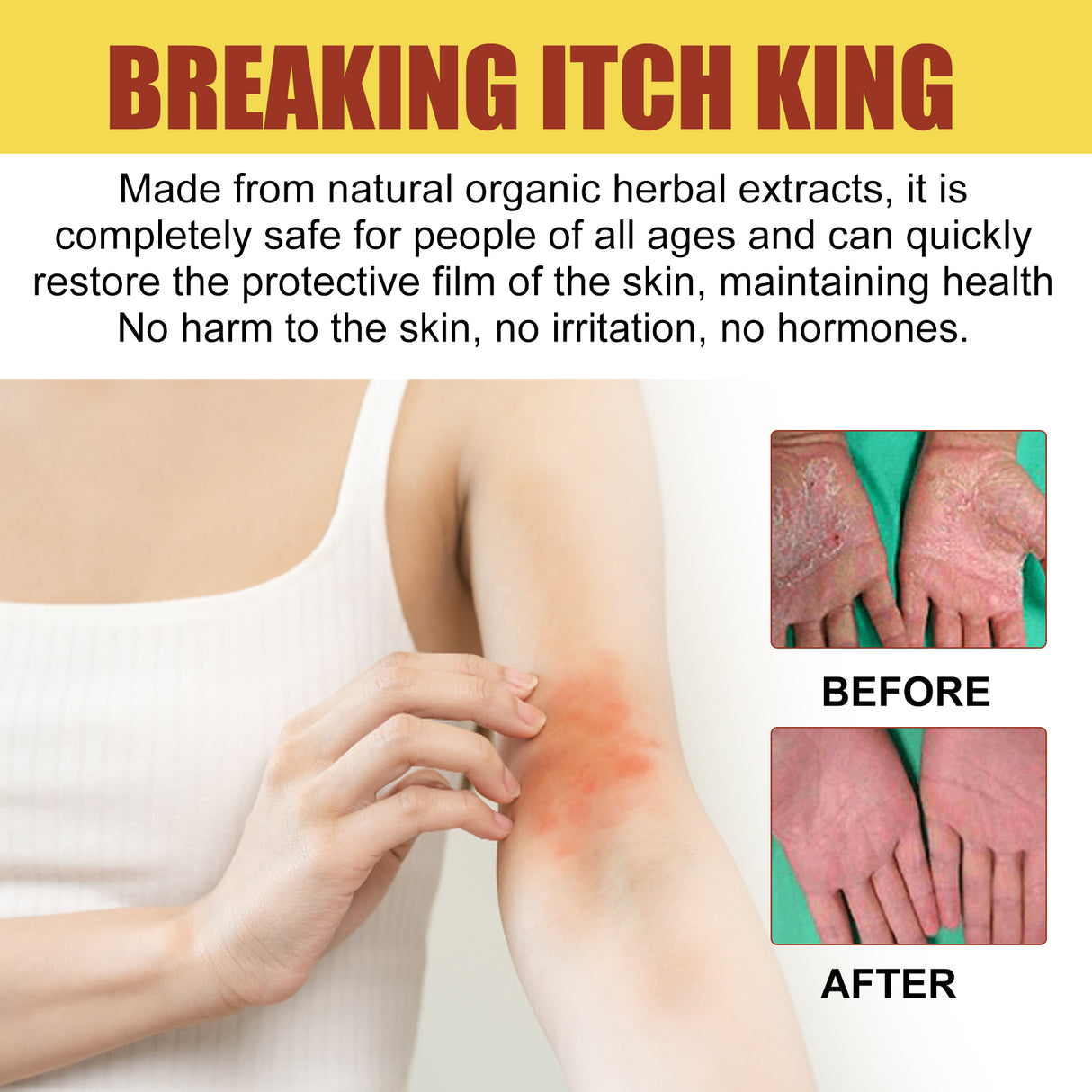 Breaking Itch King, Relieve Hand And Foot Moss Skin Moss Redness Repair Skin Itching Skin Care Cream - V.I.P Digital Presence