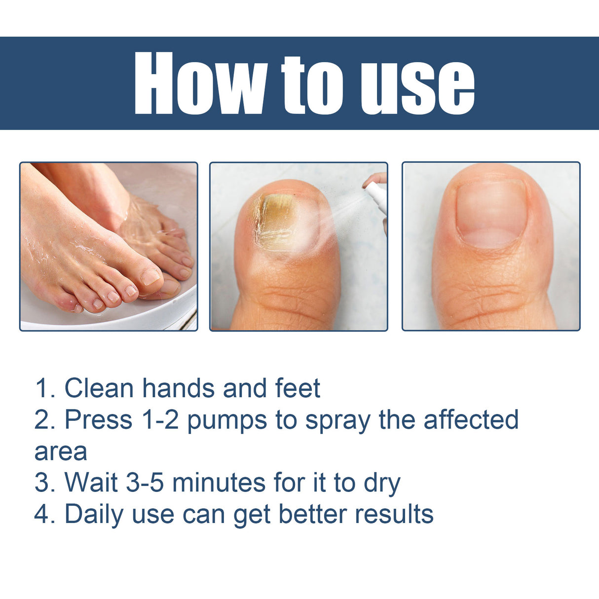 Nail Care Spray Gently Cleans Foot Nails Moisturizing And Brightening Nail Care Spray - V.I.P Digital Presence