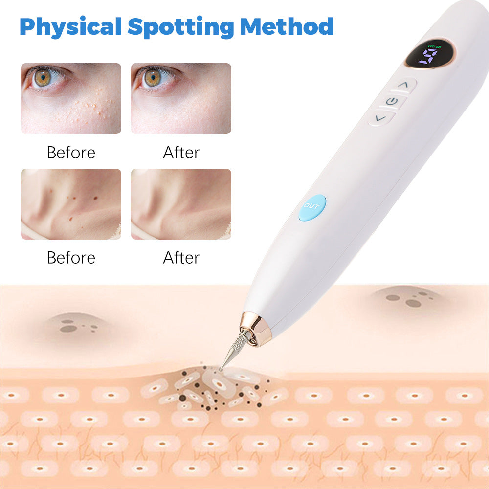 Removal Of Granulation Wart Tattoo Wart Spot Plug-In 9-Speed Laser Sweep Spot Mole Pen With Point Mole Pen Needle - V.I.P Digital Presence