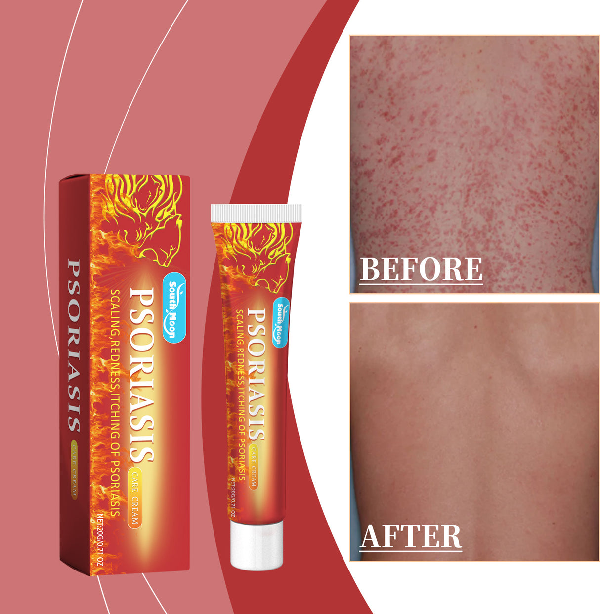 Skin Care Cream, A Gentle Formula To Moisturize Dry Skin - V.I.P Digital Presence