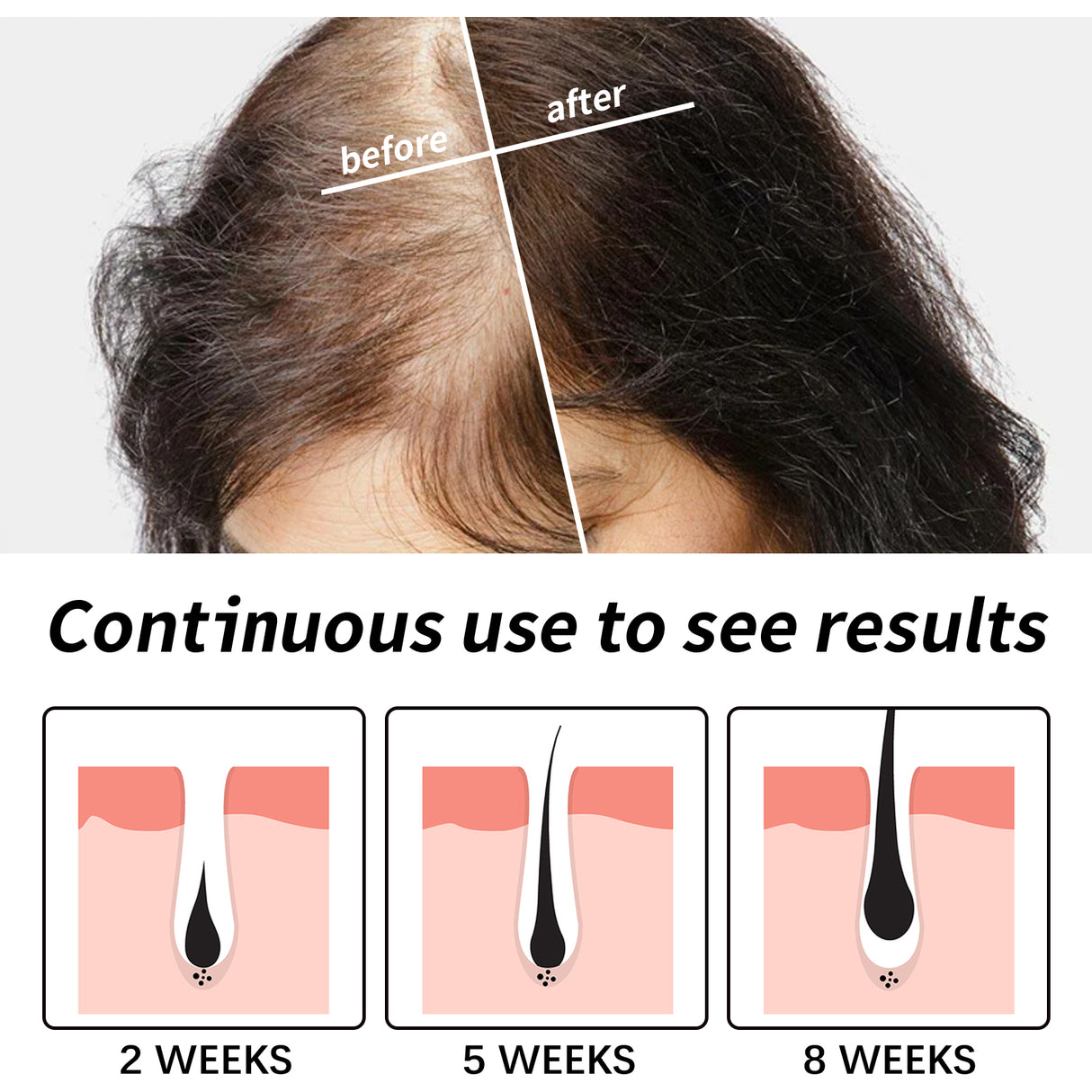 Hair Essence, Repair Dry Hair, Moisturize Hair Roots And Scalp Hair Essence - V.I.P Digital Presence