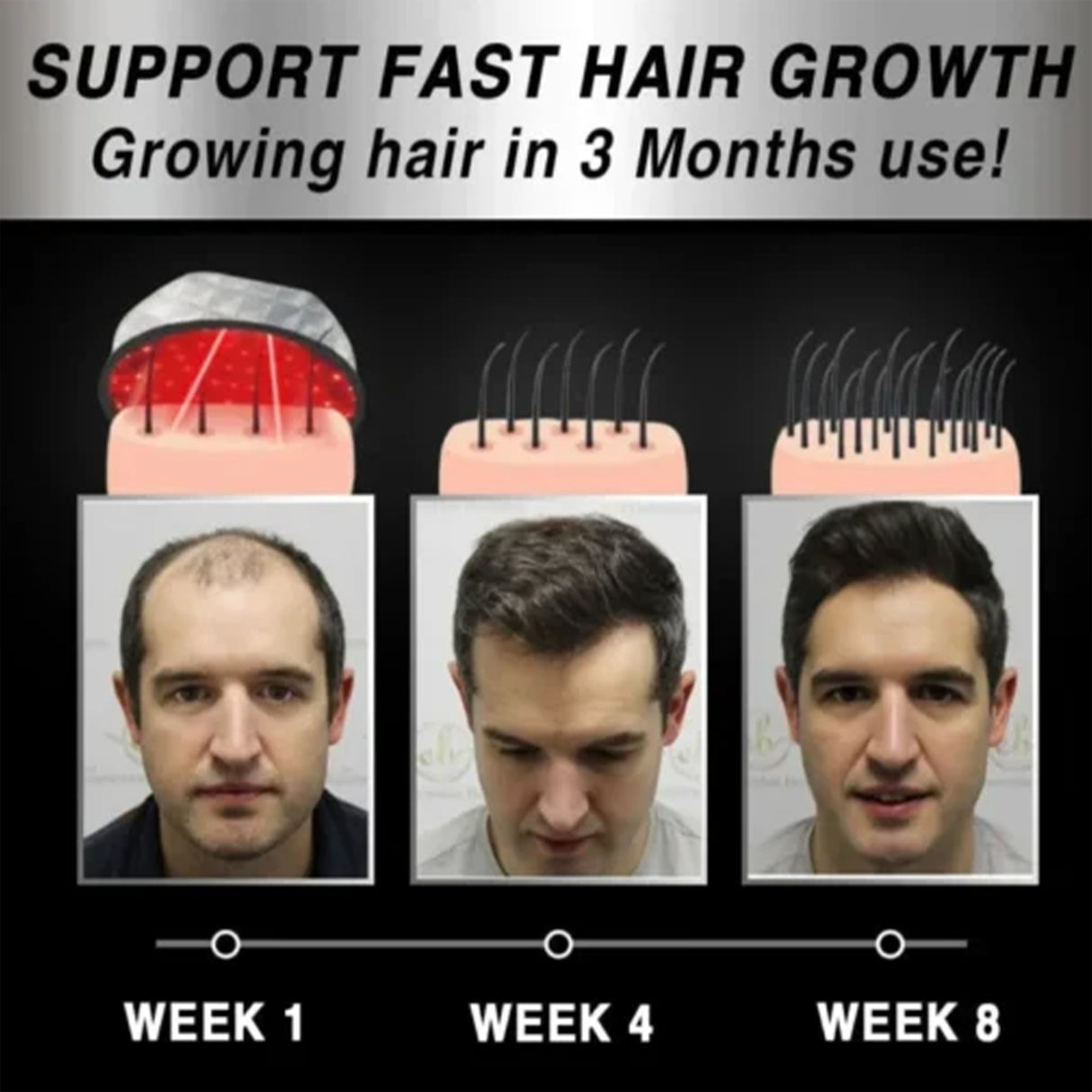 Moving Hair Growth Treatment, Repair Frizzy, Smooth And Dense Hair Scalp Care Heating Massage Cap - V.I.P Digital Presence