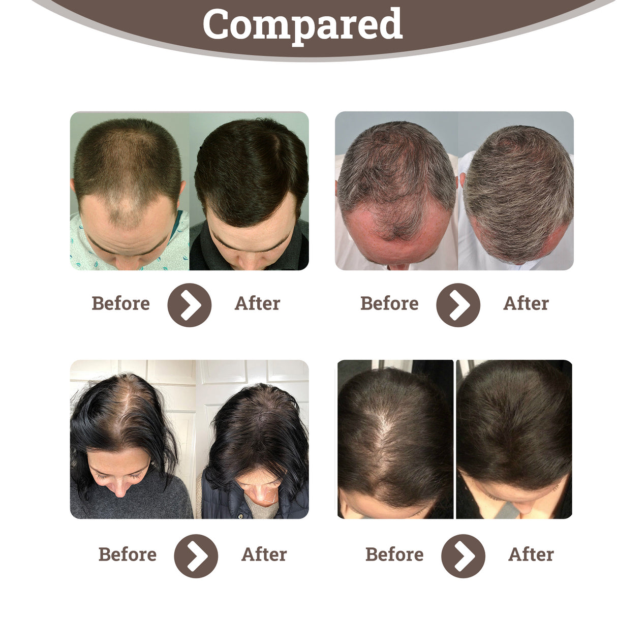 Hair Enhancement Spray Anti-Loss Hair Enhancement Repair Strong And Dense Hair Treatment Spray - V.I.P Digital Presence