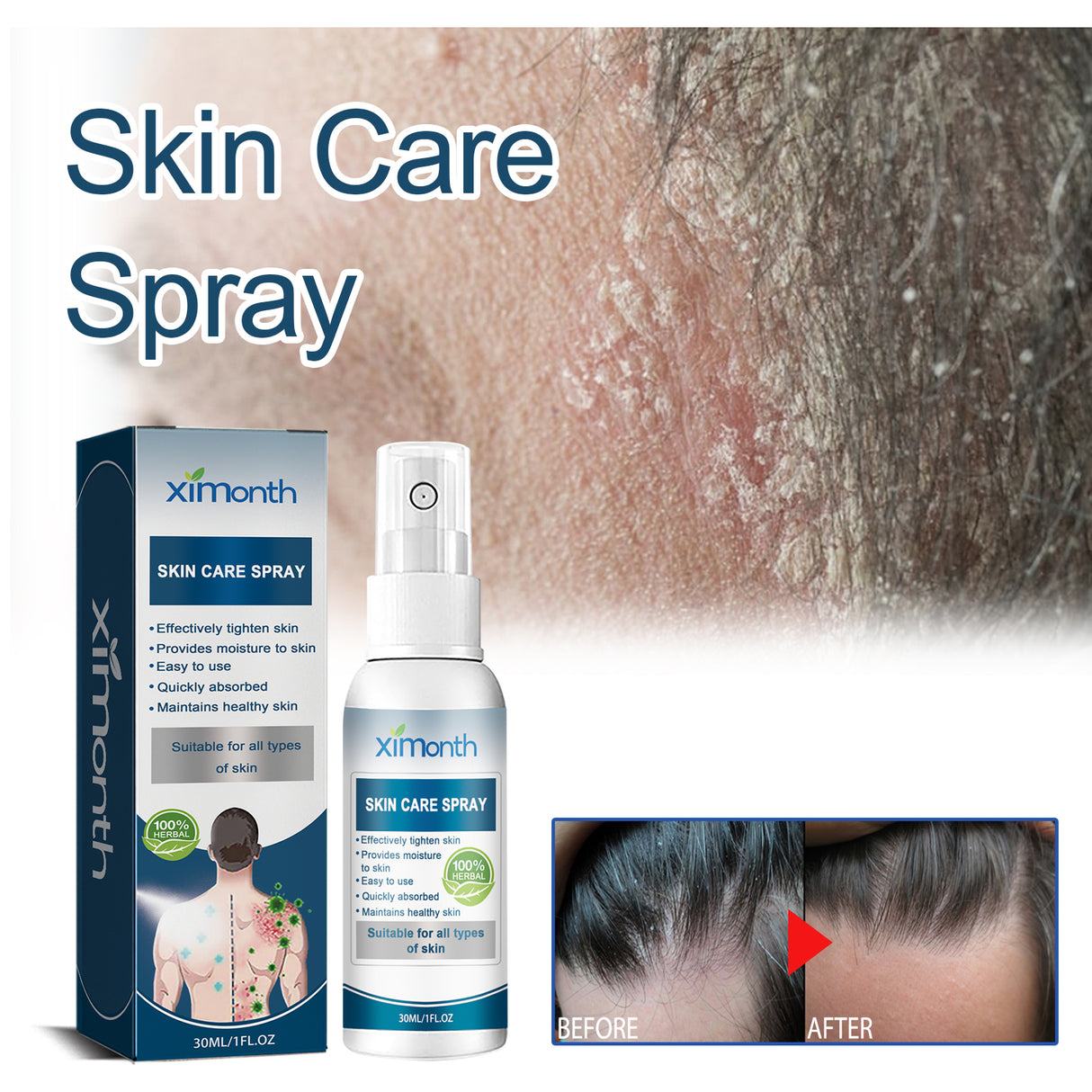 Cowhide Moss Repair Spray Relieves Redness And Itchy Scalp Skin Repair Spray - V.I.P Digital Presence