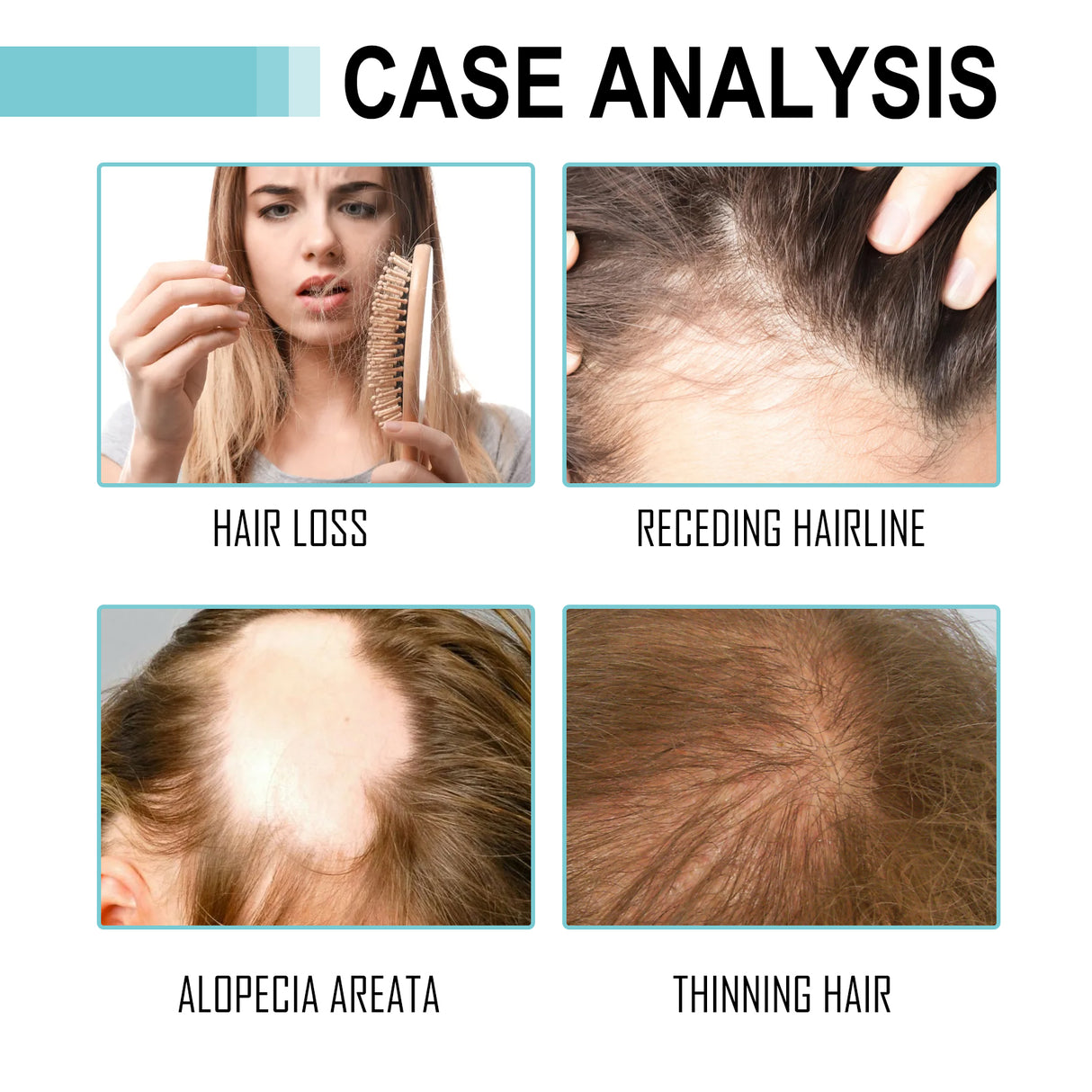 Multi-Peptide Serum For Hair Density, Fall Prevention Dense Hair Repair Damaged Hair Supple Hair Moist Hair Hair Oil - V.I.P Digital Presence