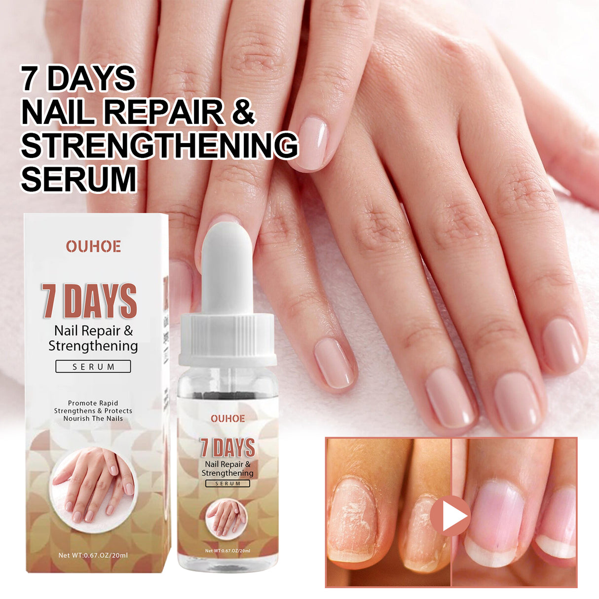 7 Day Nail Repair Essence, Hand And Foot Gray Nail Brightening Soft Nail Thickening Toenail Care Solution - V.I.P Digital Presence