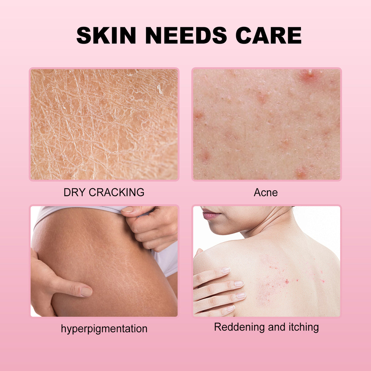 Strawberry Body Care Oil Moisturizes Tender And Firming Skin Full Body Massage Body Care - V.I.P Digital Presence