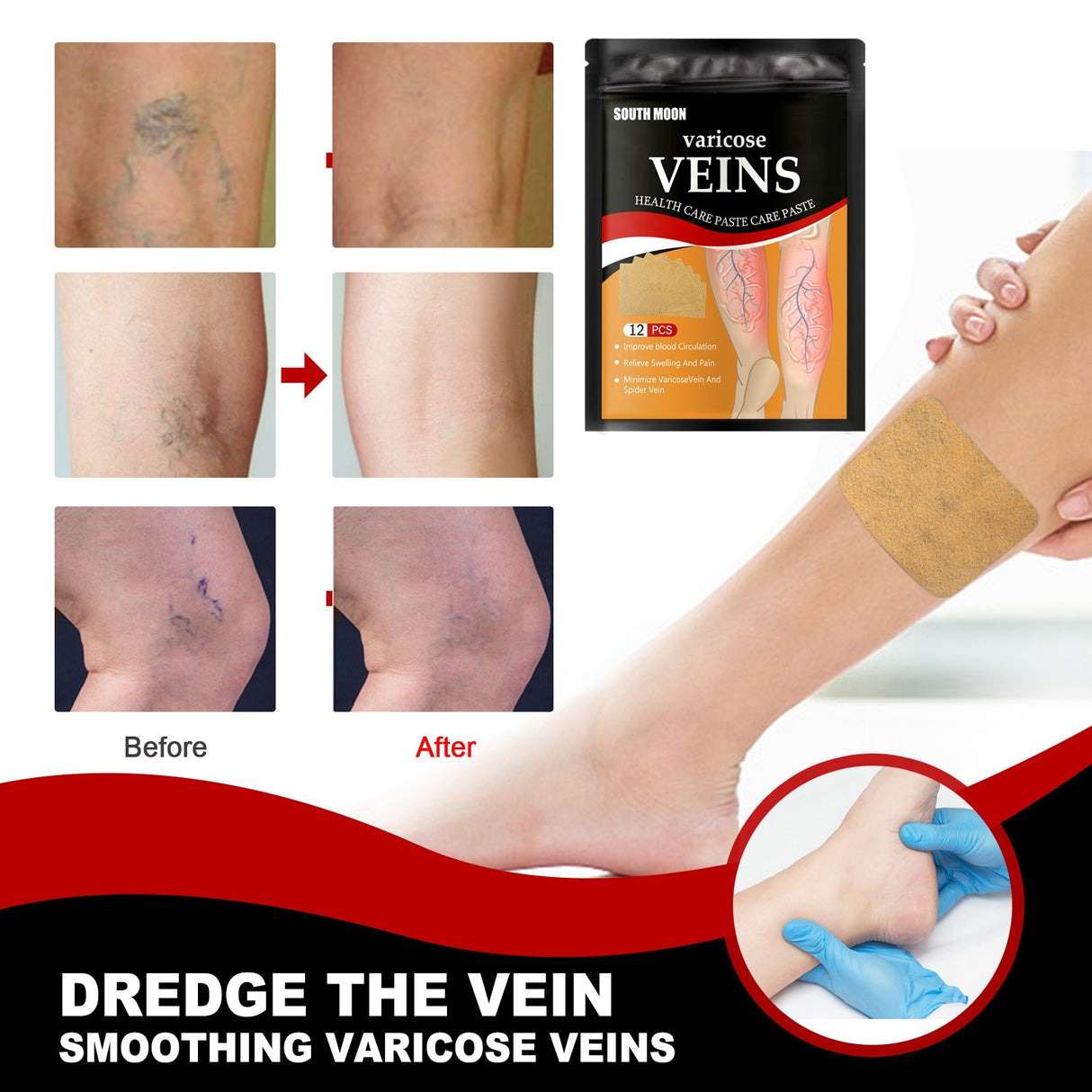 Venous health patch relieves varicose blood vessel blockage and protrusions in the feet. Cold compress venous health patch - V.I.P Digital Presence