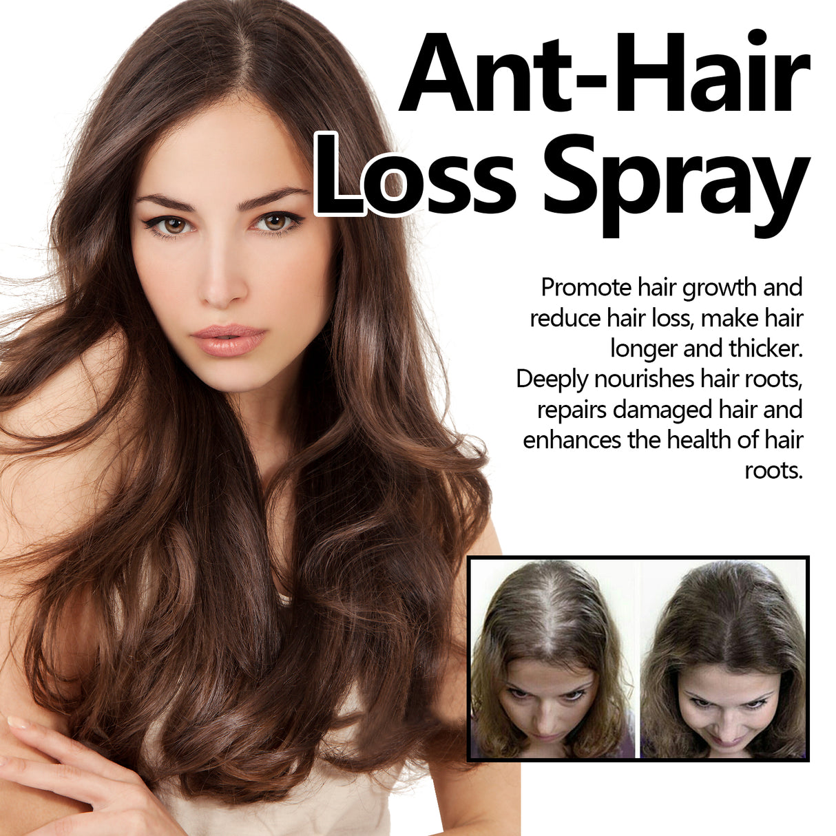 Ant-Hair Loss Spray, Nourish Hair Repair Dry Strong Hair And Protect Hair Thick Hair - V.I.P Digital Presence