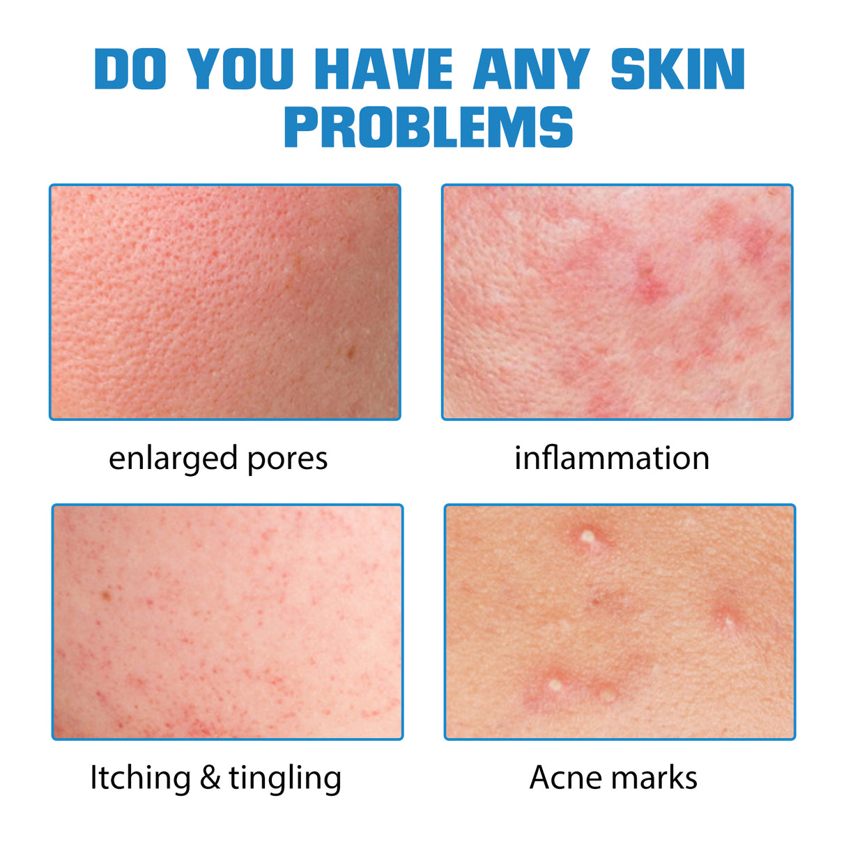 Hyaluronic Acid Face Serum, Moisturizing Repair Lighten Acne Mark Skin Care Whitening Essence - V.I.P Digital Presence