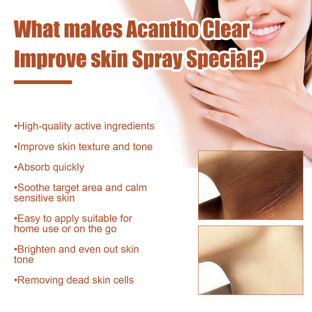 Acantho Clear Improve Skin Spray, Repair Black Spot, Elbow Knee Joint Black Whitening Skin Spray - V.I.P Digital Presence