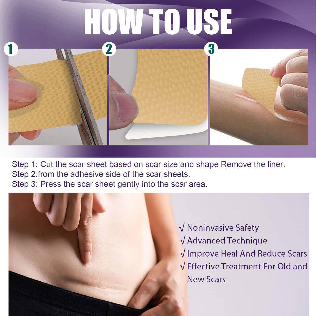 Silicone Scar Patch, Reduces Stretch Marks And Hyperplasia Of Caesarean Section Scars Silicone Patch - V.I.P Digital Presence