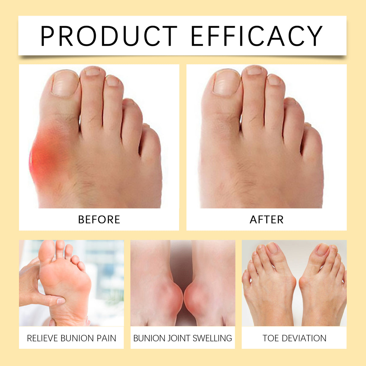 Bee Venom Care Cream, Bee Venom Care Cream To Relieve Inflammation, Pain Swelling Can Improve Joint Health Bunions Adjuvant Therapy - V.I.P Digital Presence