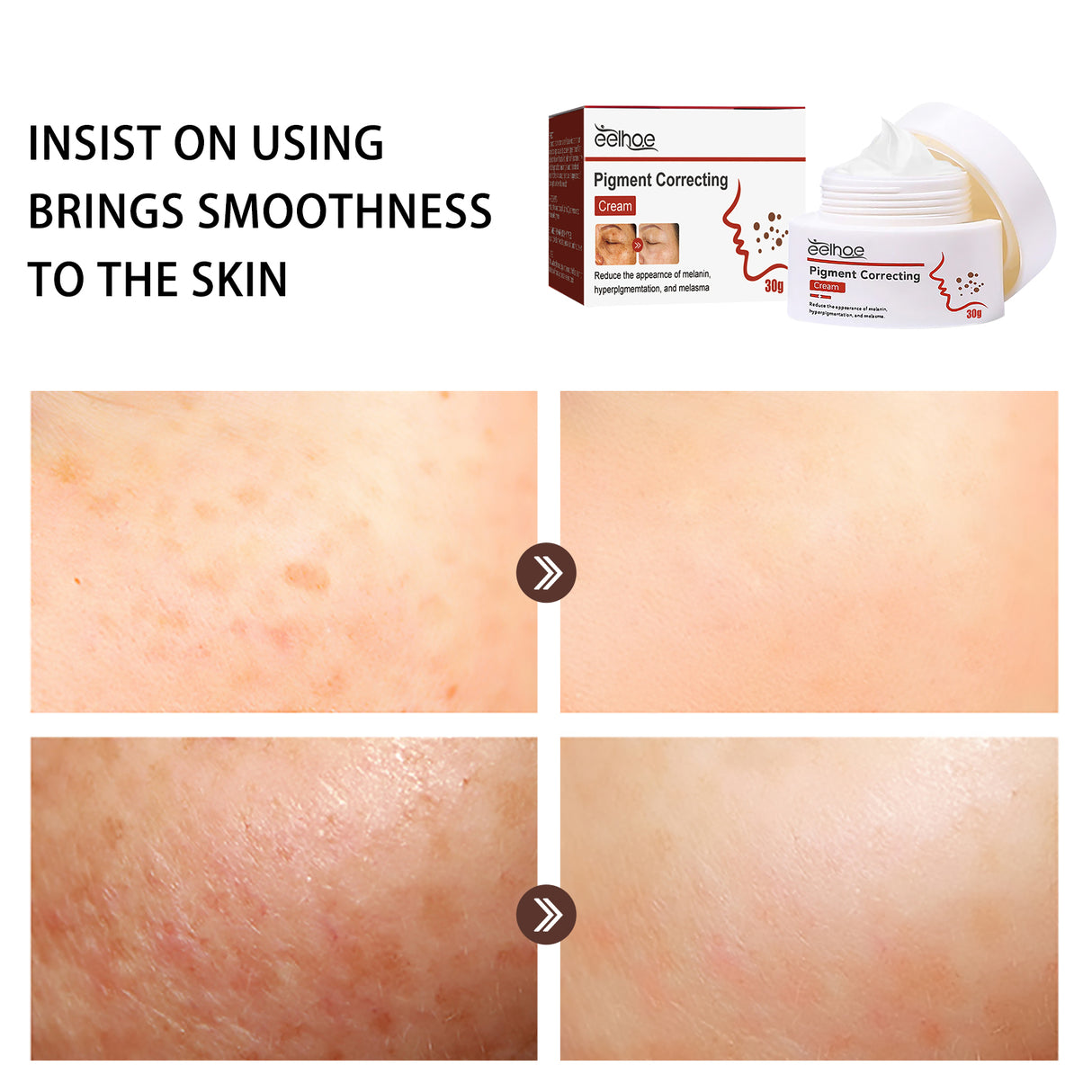 Pigment Repair Cream, Moisturizing And Lightening Freckles Dark Spots Spots Melasma Melanin Beauty Cream - V.I.P Digital Presence