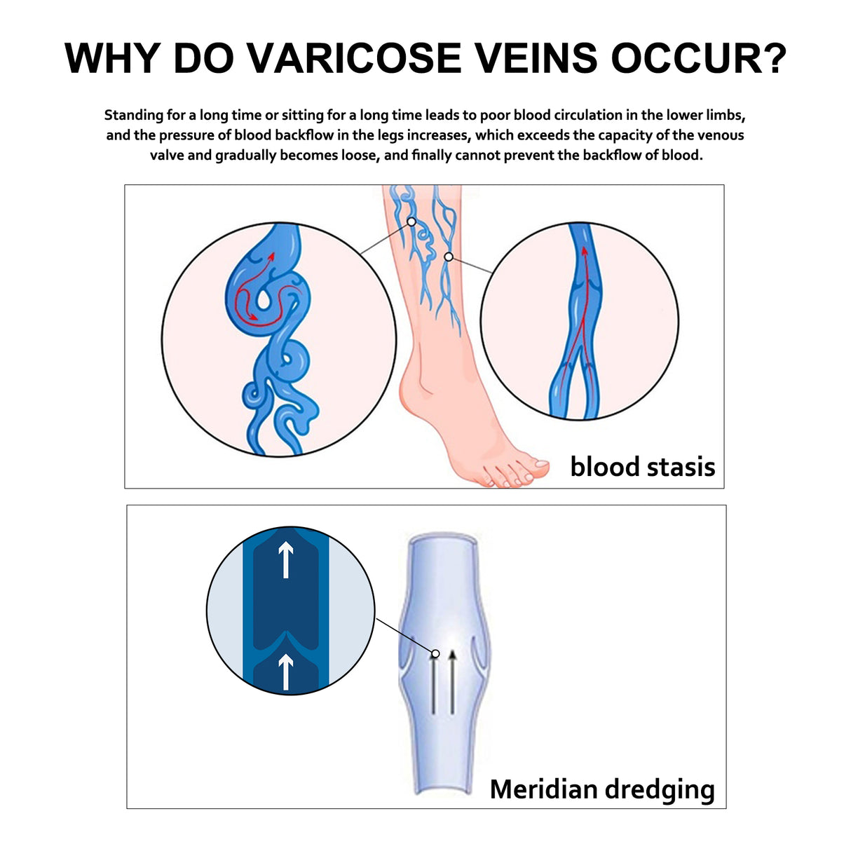 Leg Repair Cream Relieves Leg Discomfort Massage Leg Repair Cream For Raised Veins - V.I.P Digital Presence