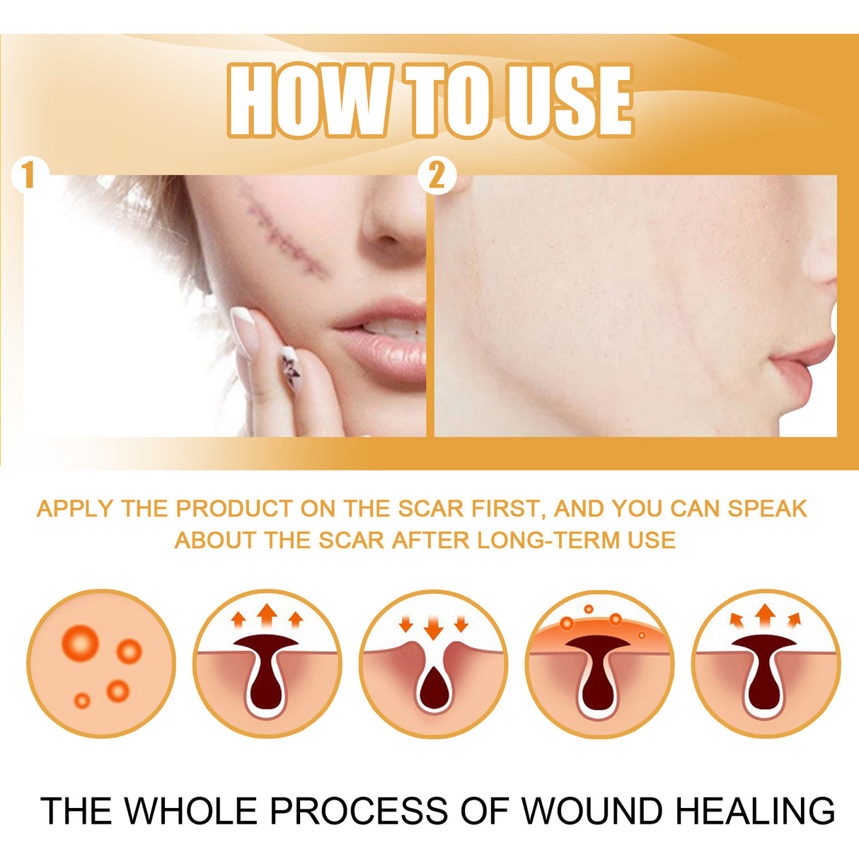 Desalting Skin Scar Cream, Skin Burn Scalding Surgical Scar Wound Repair Cream - V.I.P Digital Presence
