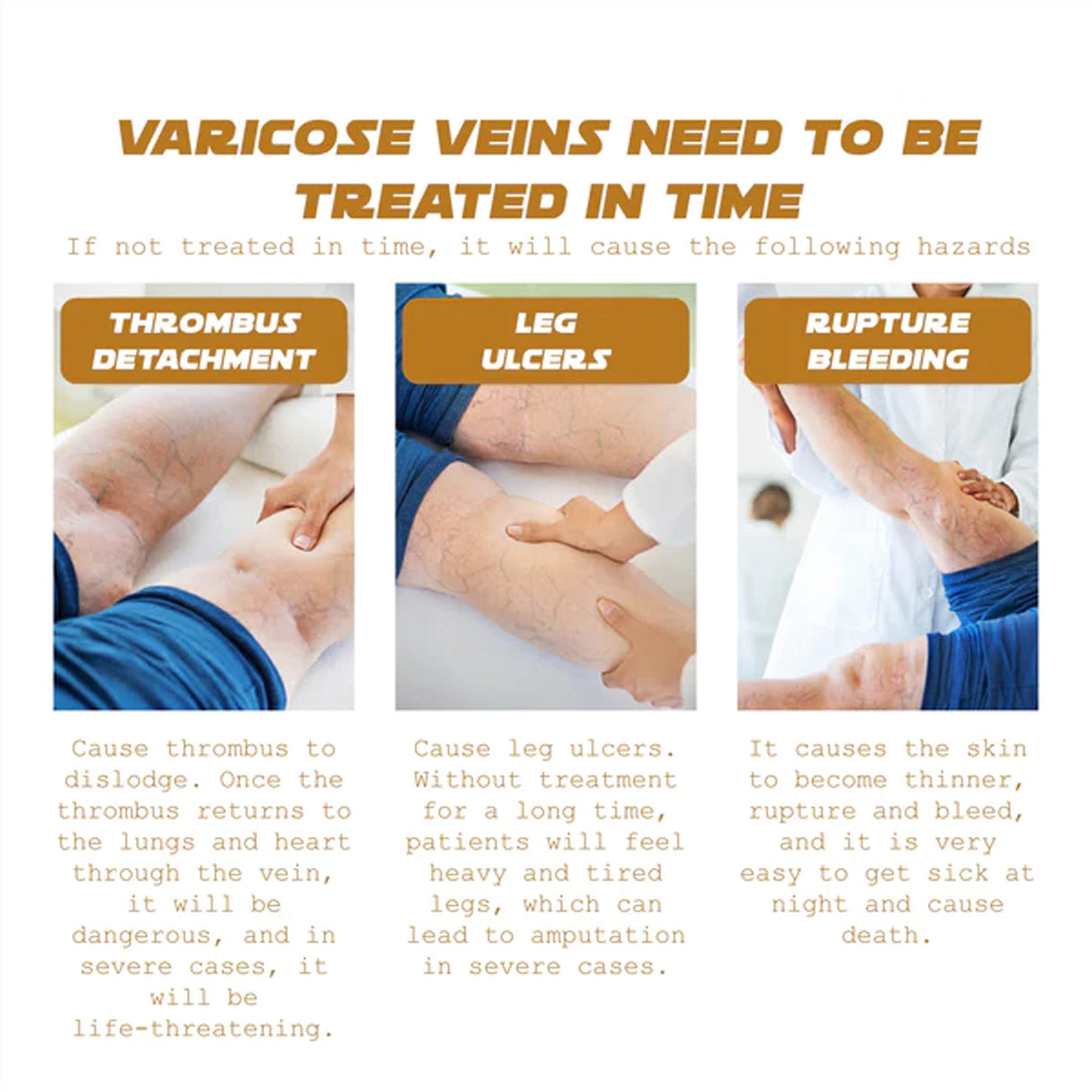 Vein Renewal Smooth Legs Cream, Relief Sore Legs Massage Varicose Earthworm Leg Vein Care Cream - V.I.P Digital Presence