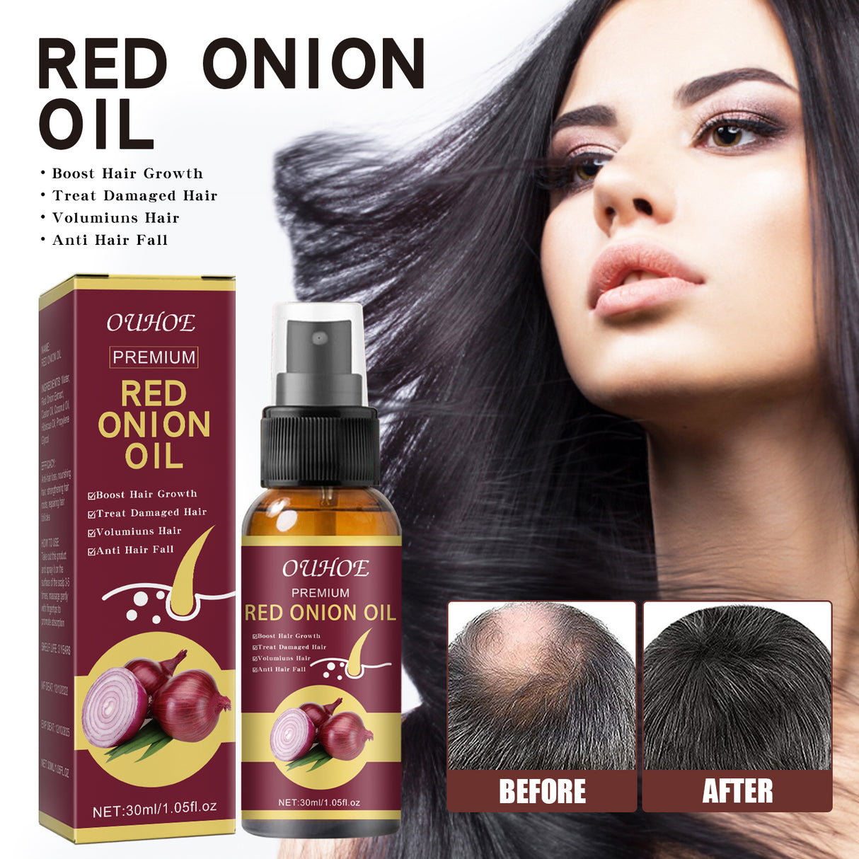 Onion Hair Growth Essential Oil, Strengthens And Hydrates Hair Growth Hair Dense Hair Care Spray - V.I.P Digital Presence