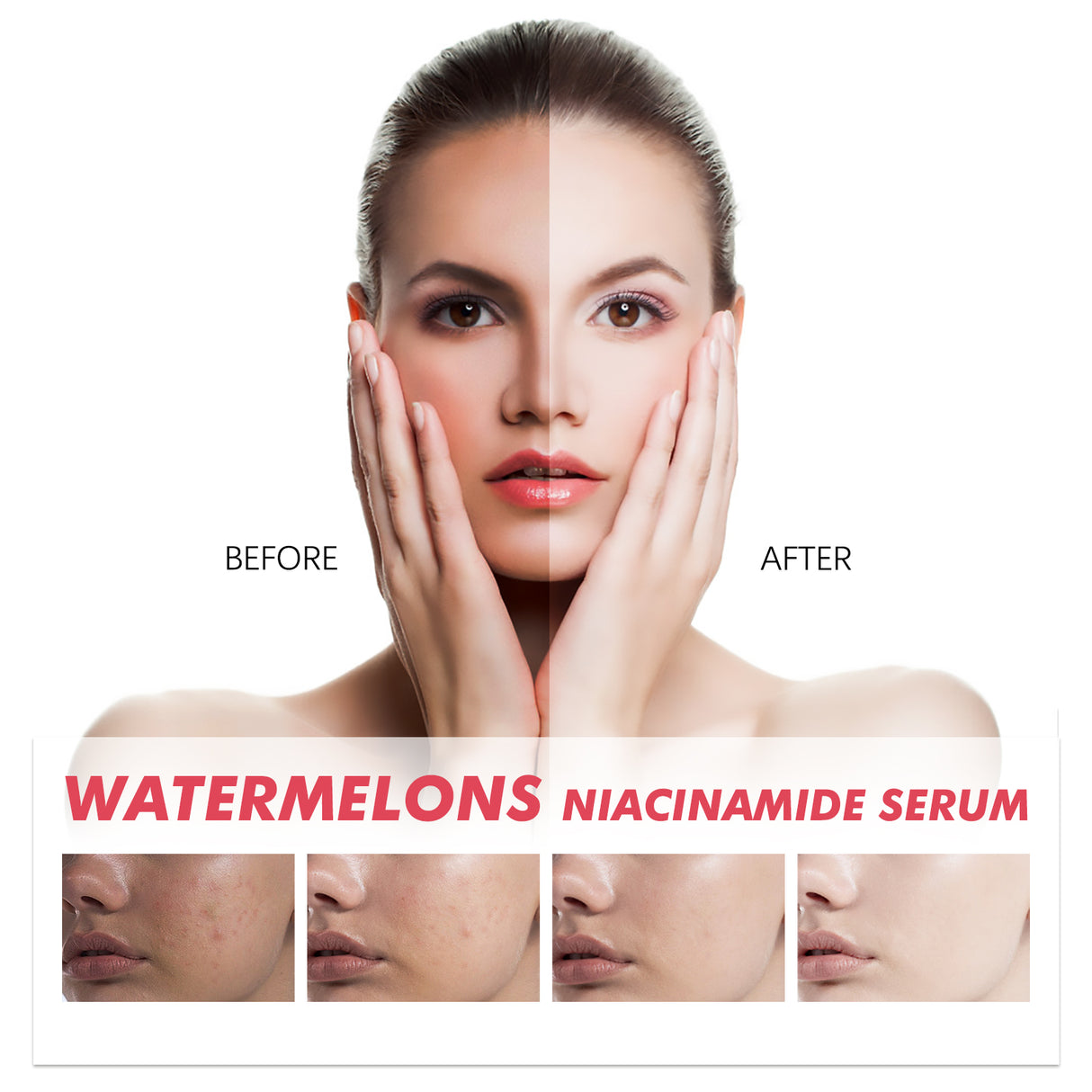 Watermelons Niacinamide Serum, Dilute Spots Firming Haun White Skin Hydrating Moisture Essence - V.I.P Digital Presence