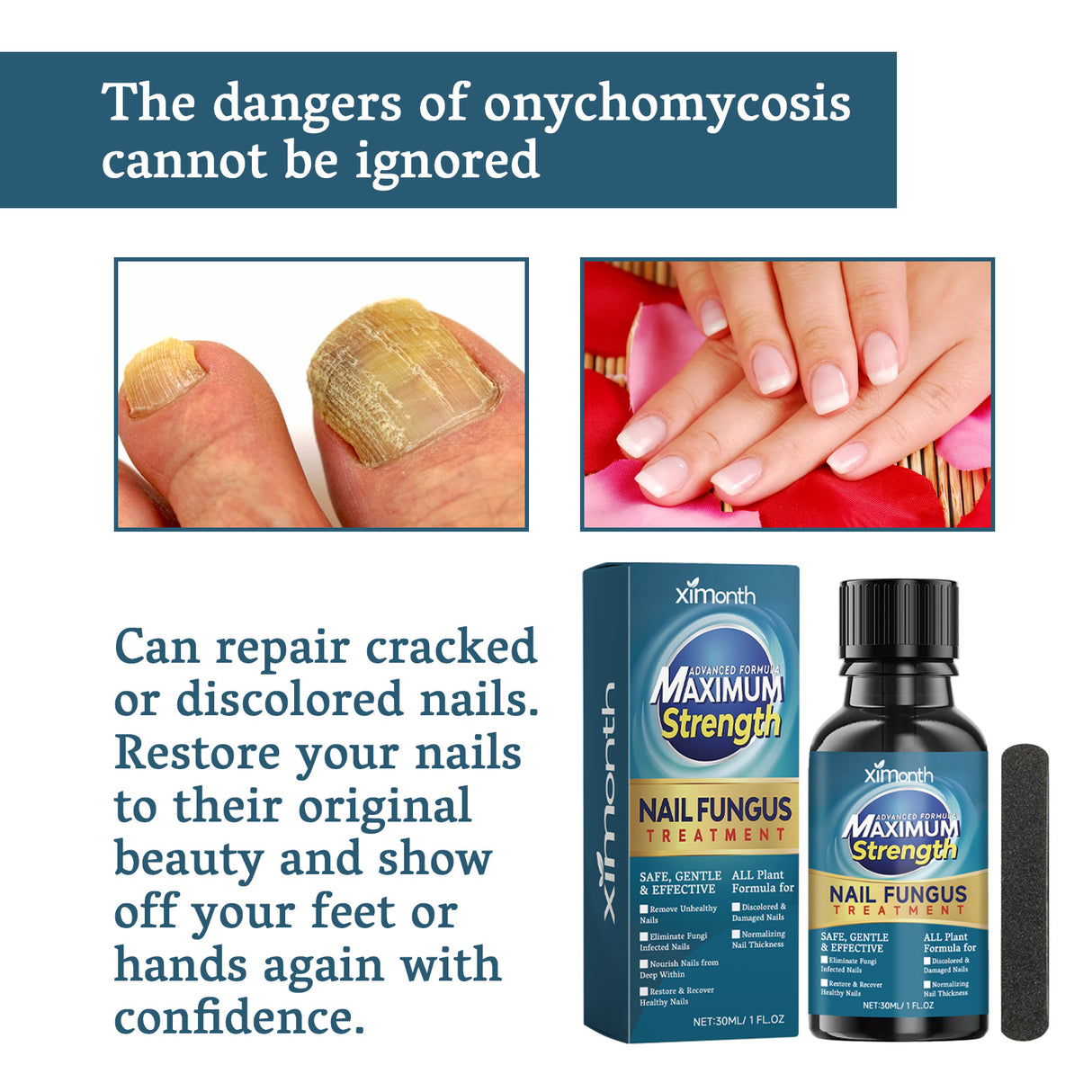 Nail Fungus Treatment, Nail Thickening Of Embedded Light Mail This Soft Armour Brothers Nails Detailer - V.I.P Digital Presence